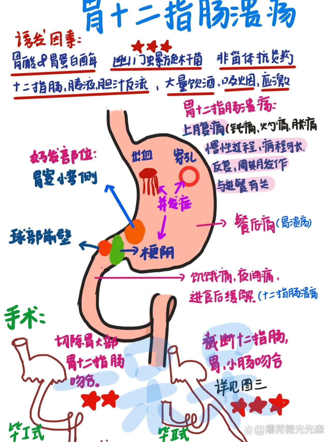 十二指肠溃疡怎么检查图片