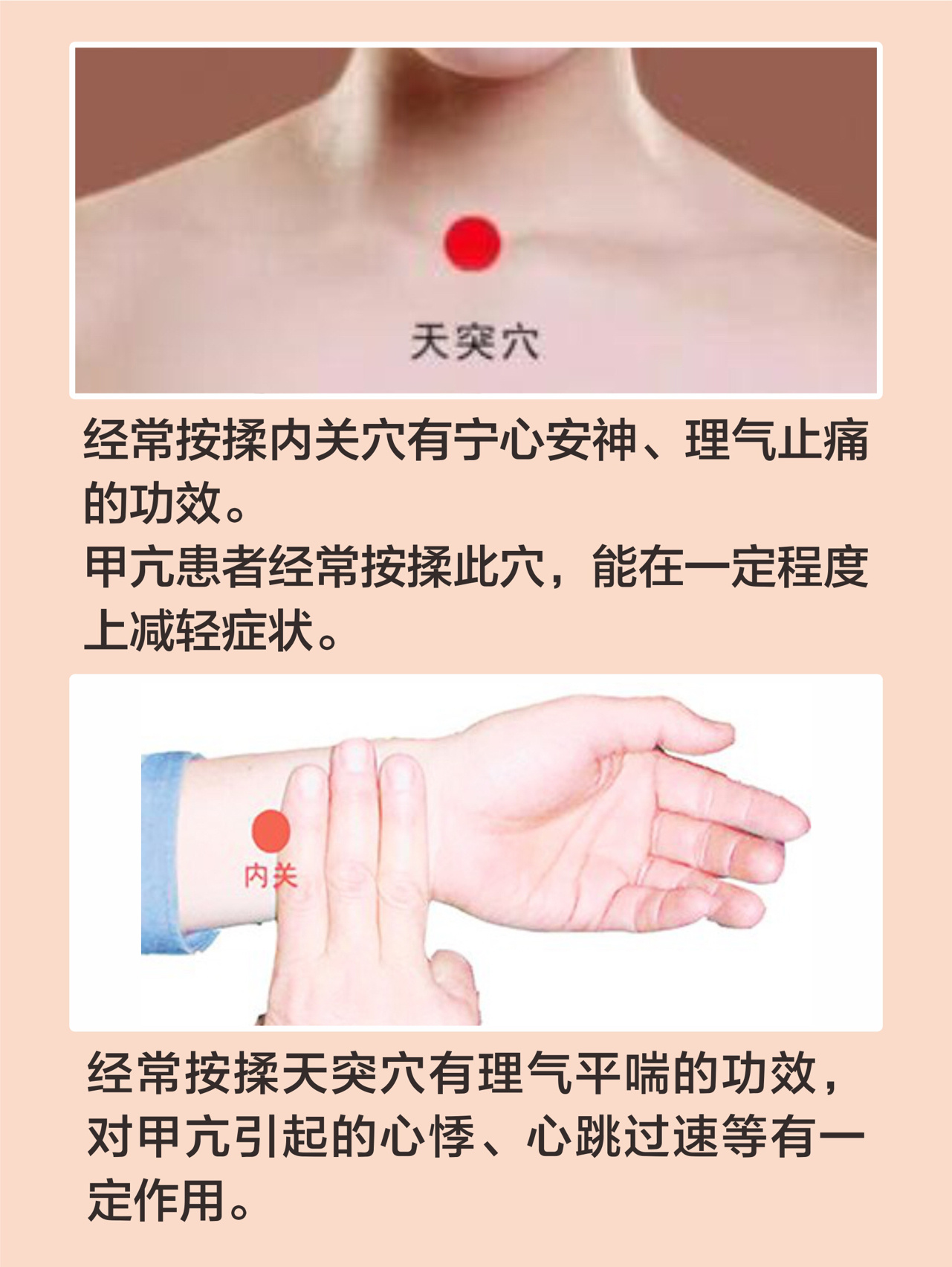 这两个穴位,甲亢患者一定要多按按❗