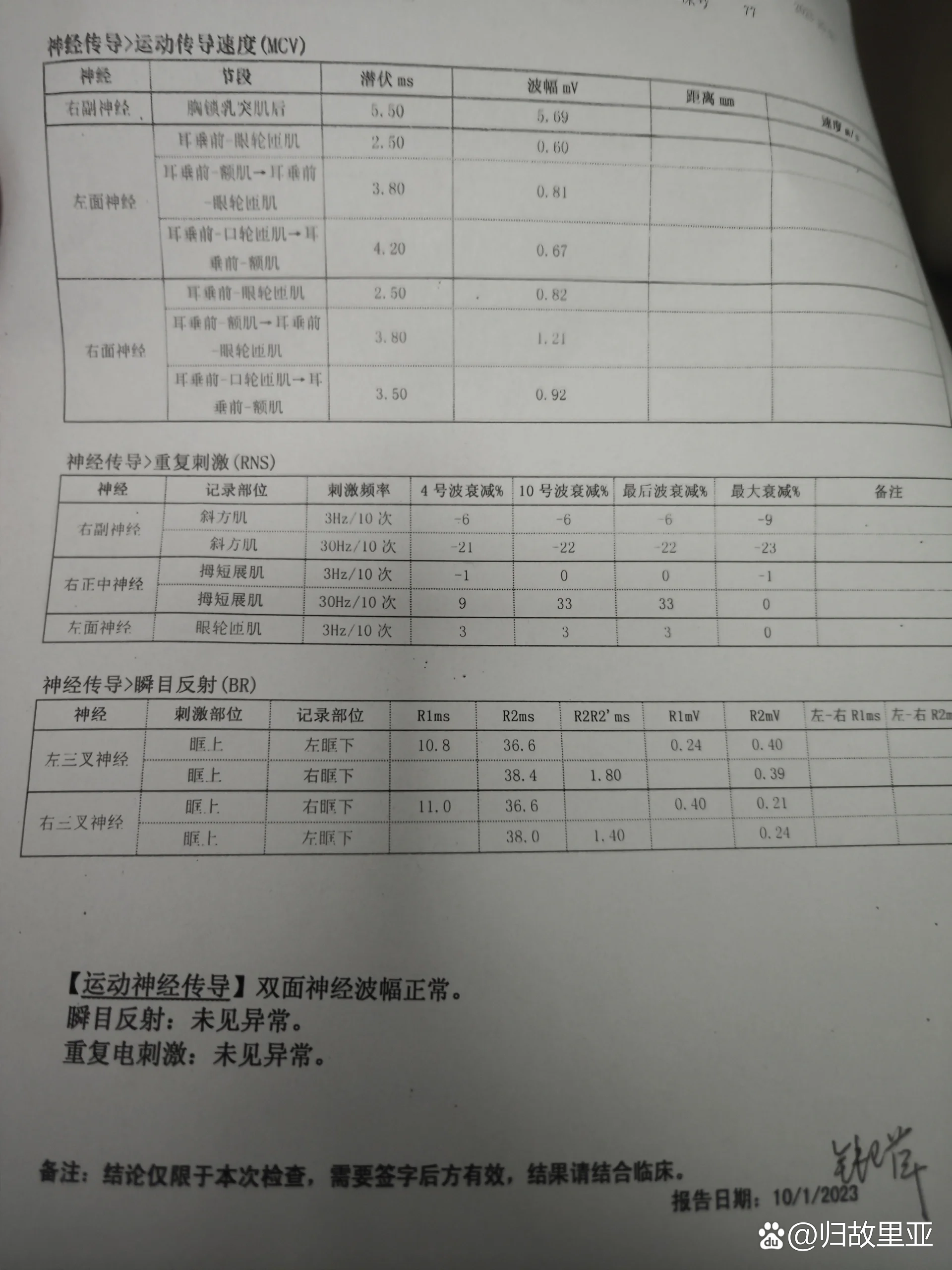 面神经肌电图结果解读图片