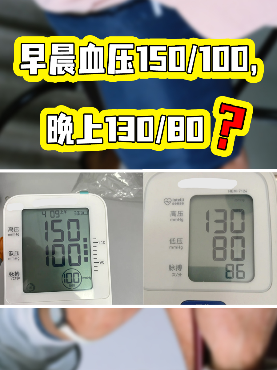 我这血压,早上150/100mmhg,到了晚上又变成130/80mmhg,这是咋回事啊?