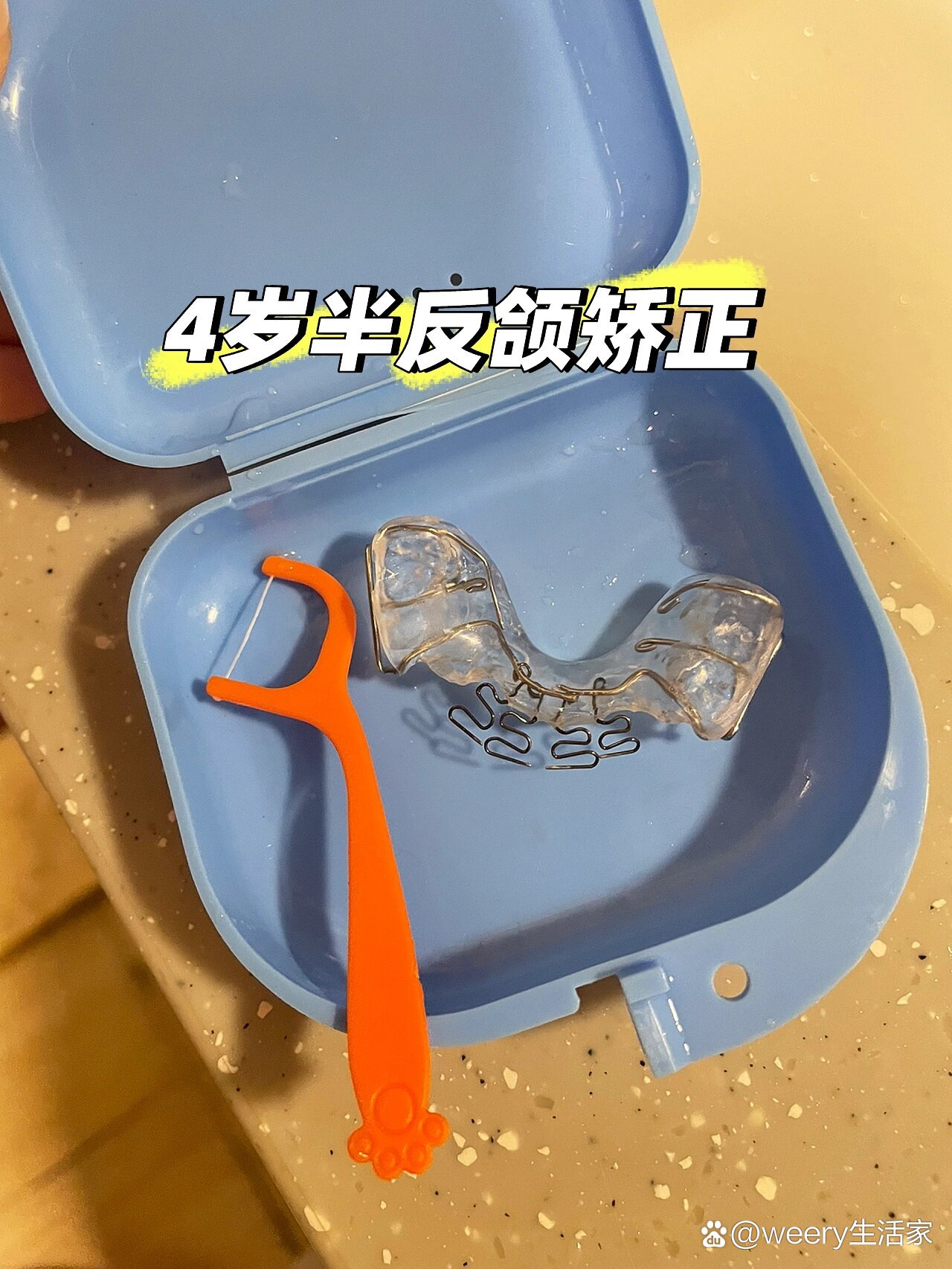 后续来啦~4岁半反颌矫正