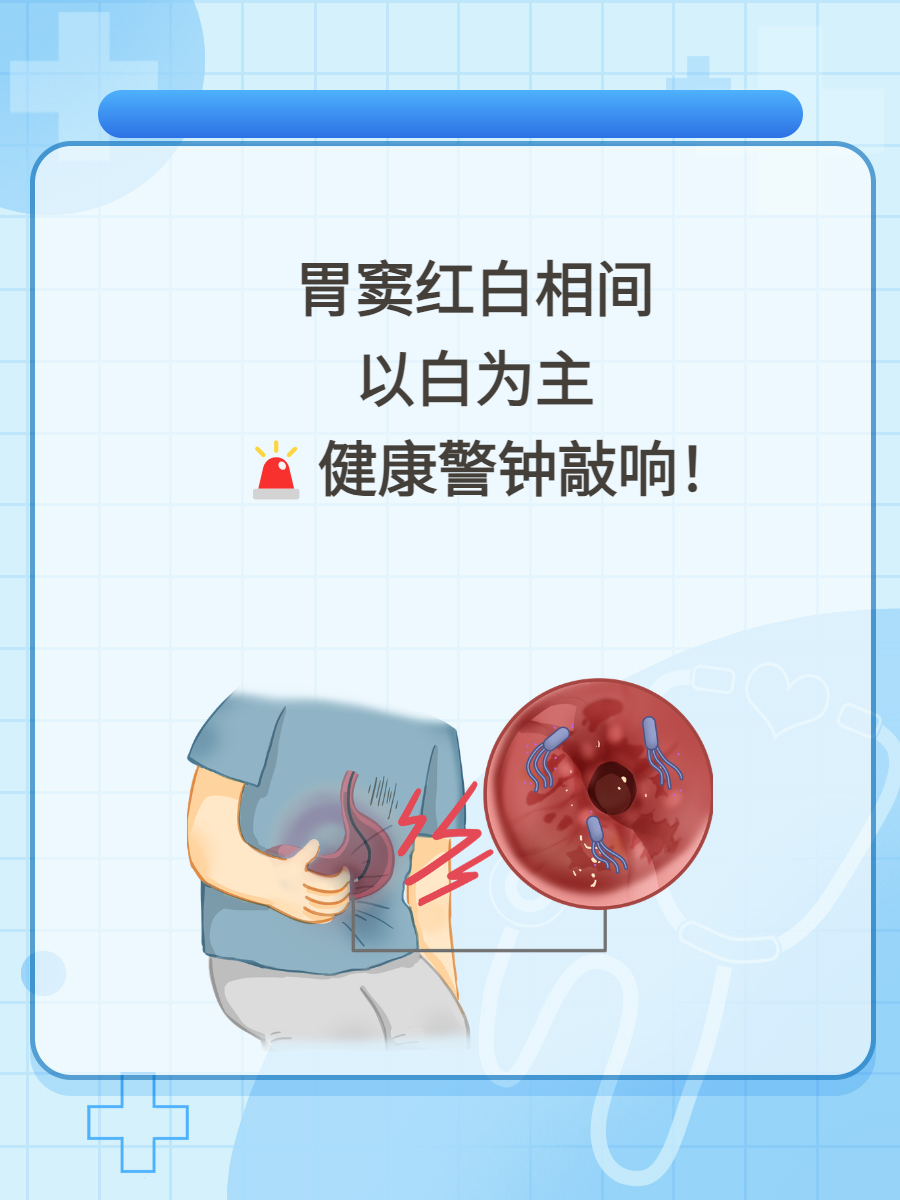 胃窦红白相间,以白为主,健康警钟敲响!