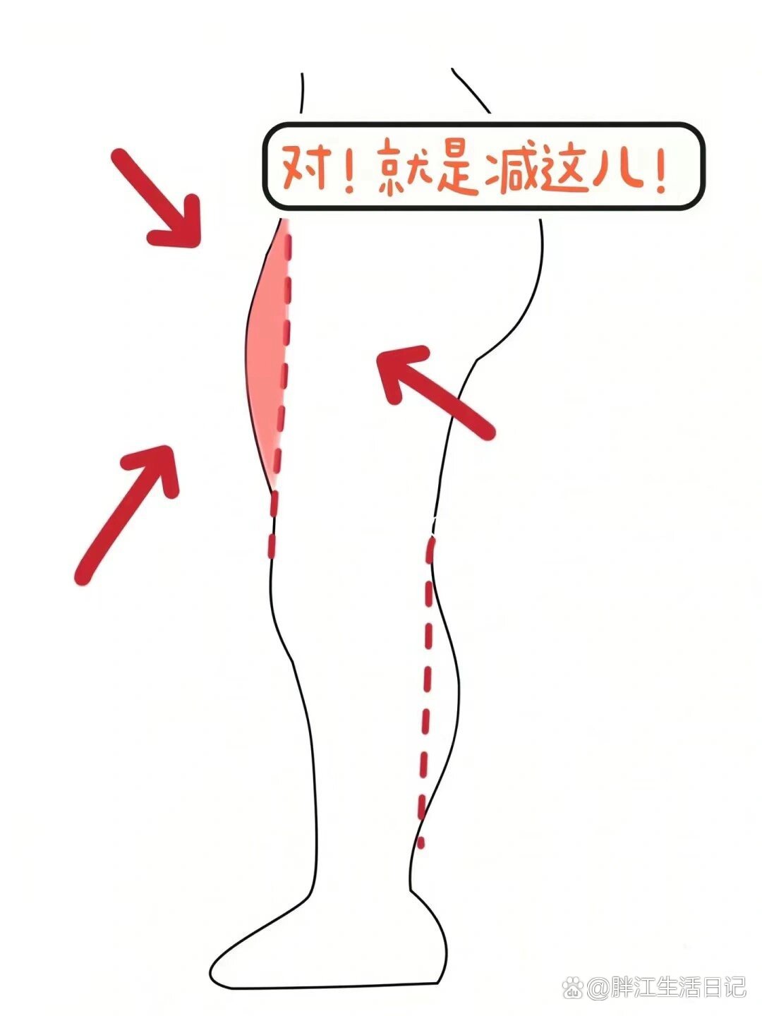 为什么大腿前外侧会鼓?