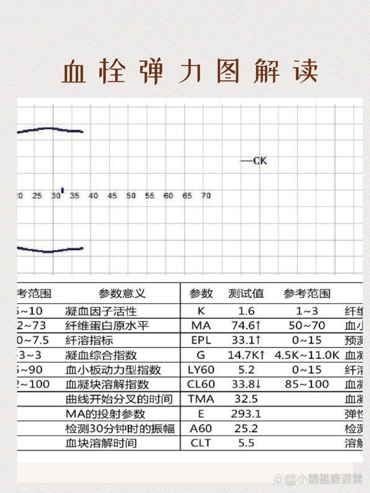 血栓弹力图检验报告图片