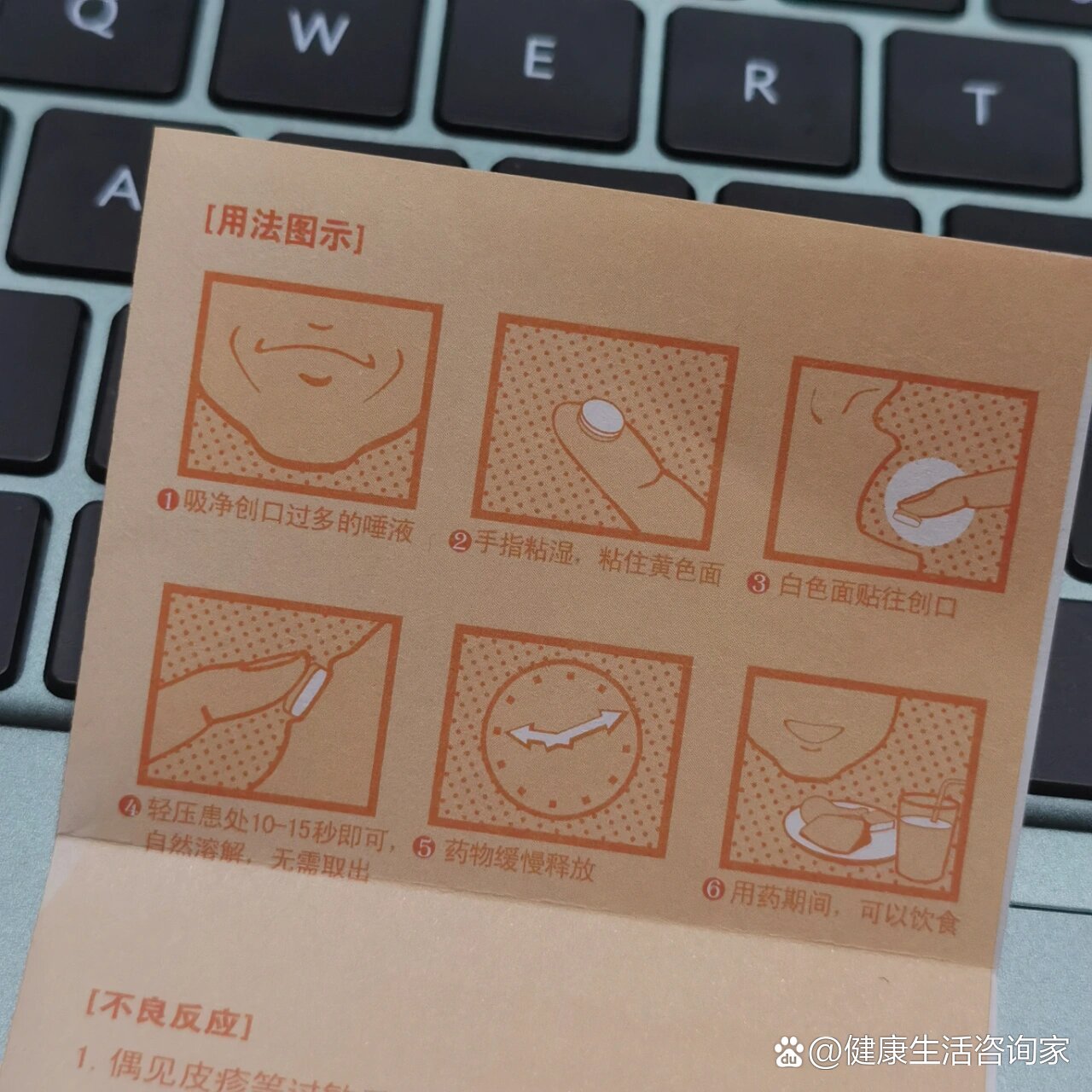 口腔溃疡人01意可贴!