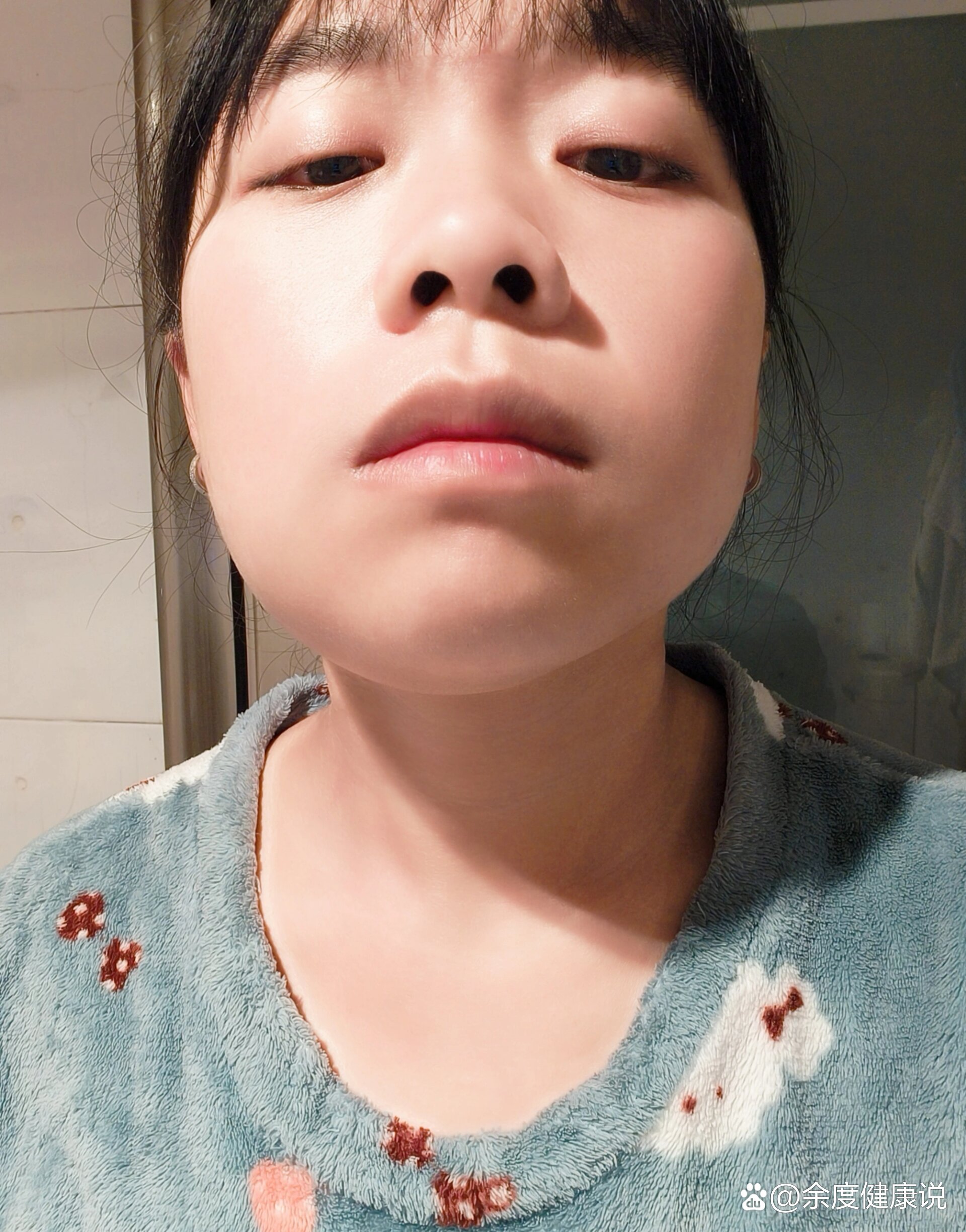 拔了智齿第三天,耳朵痛