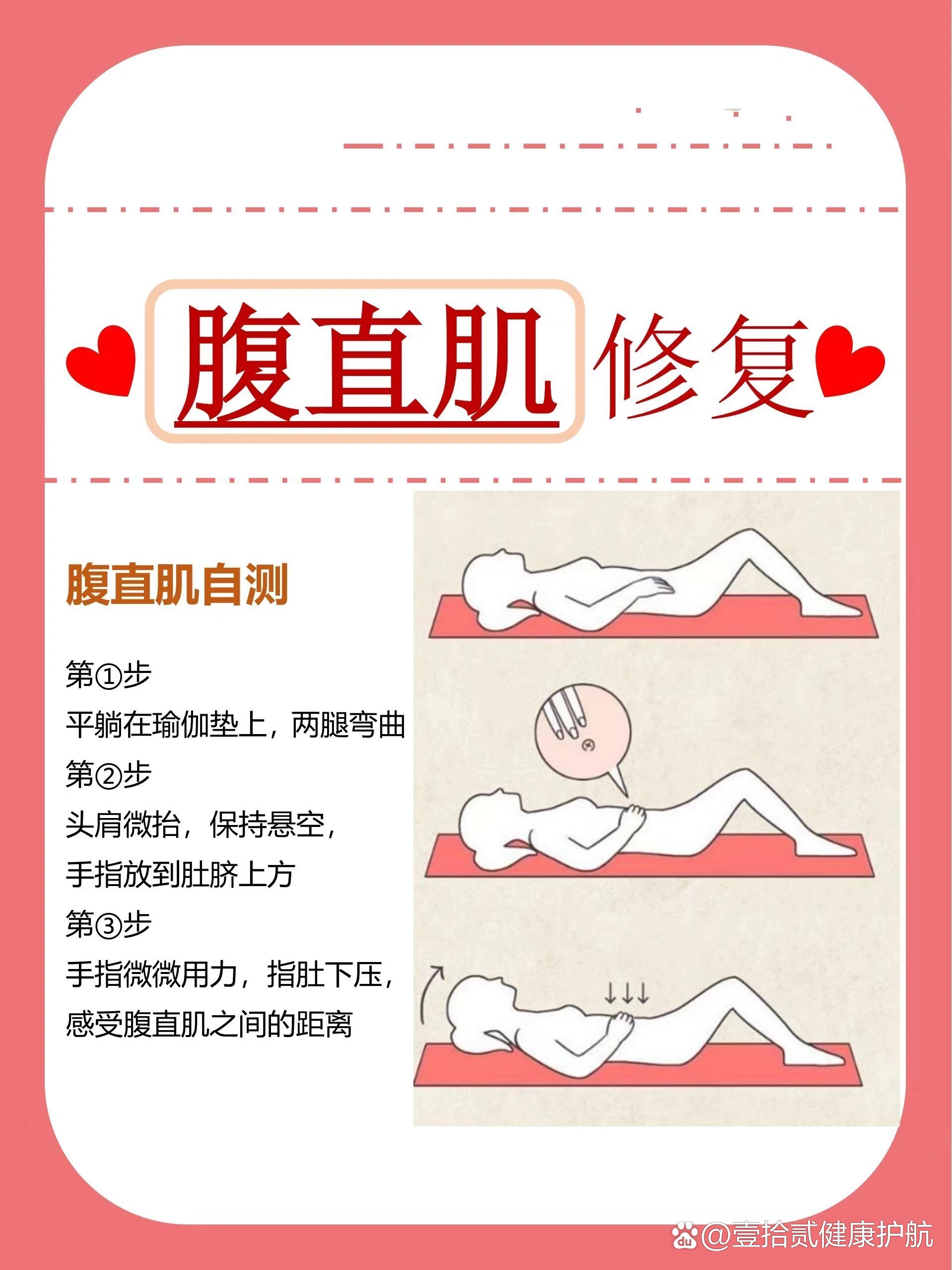 9215腹直肌修复要不要做71新手妈妈看过来75