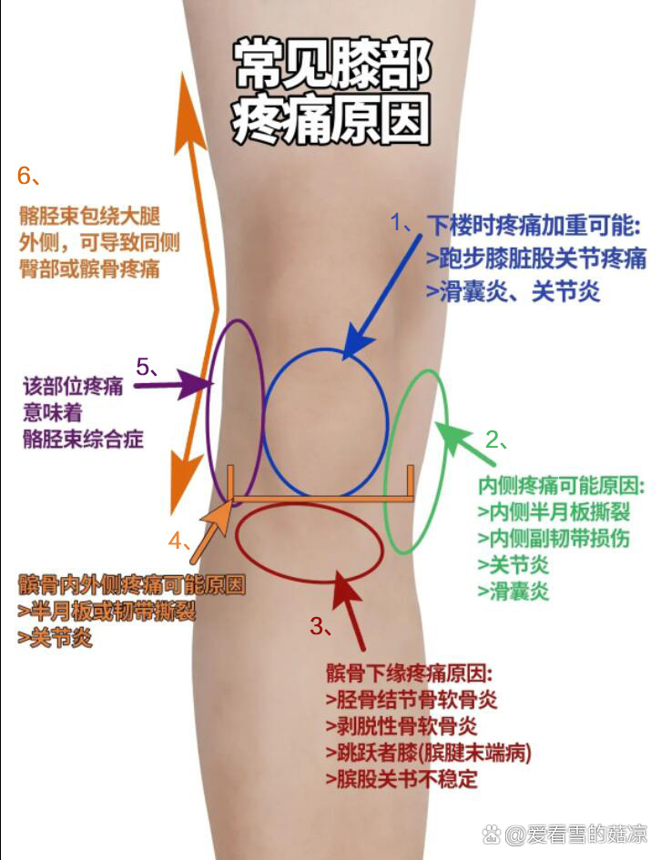 髌前滑囊炎图片