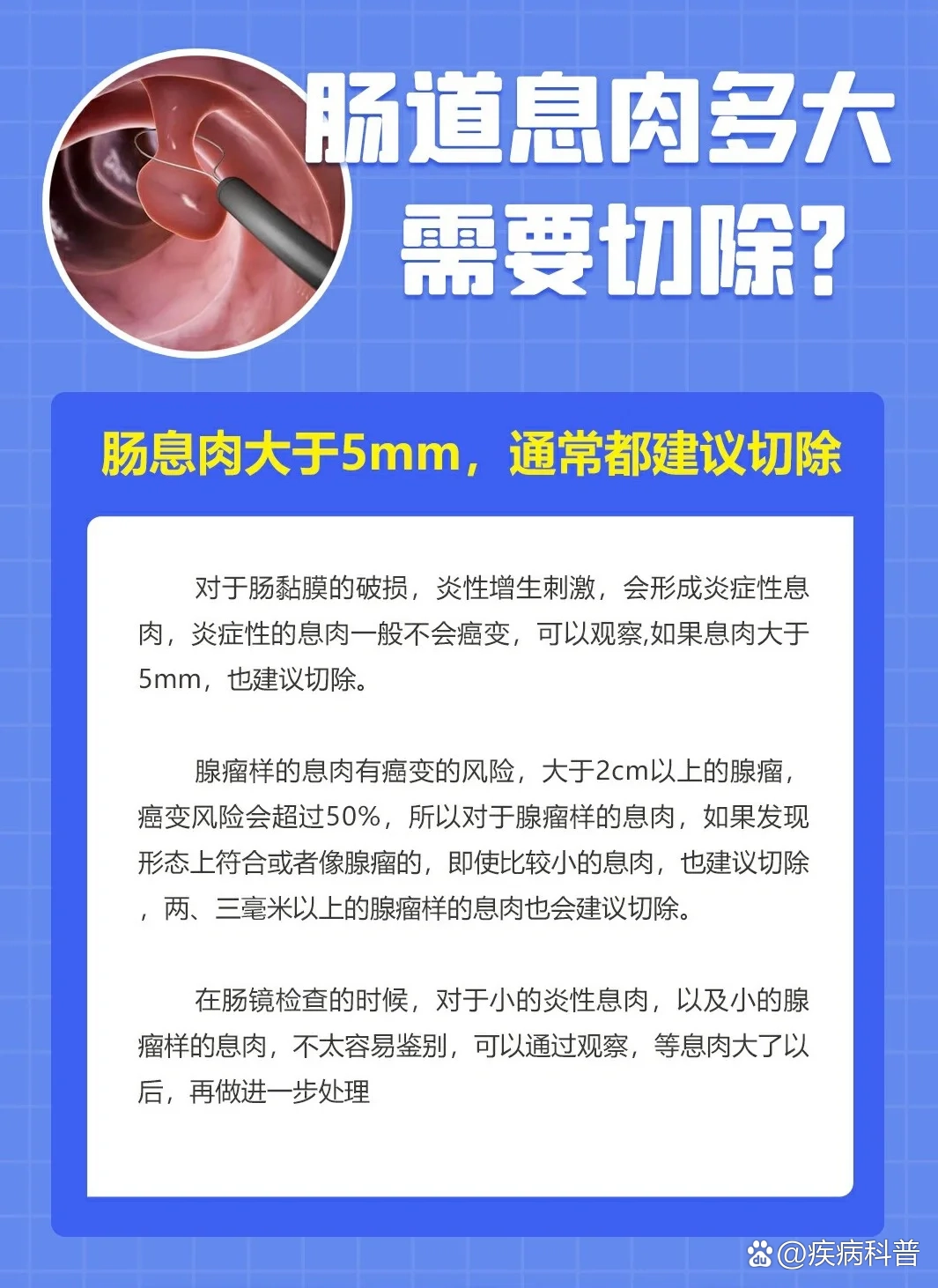 肠道息肉多大需要切除?