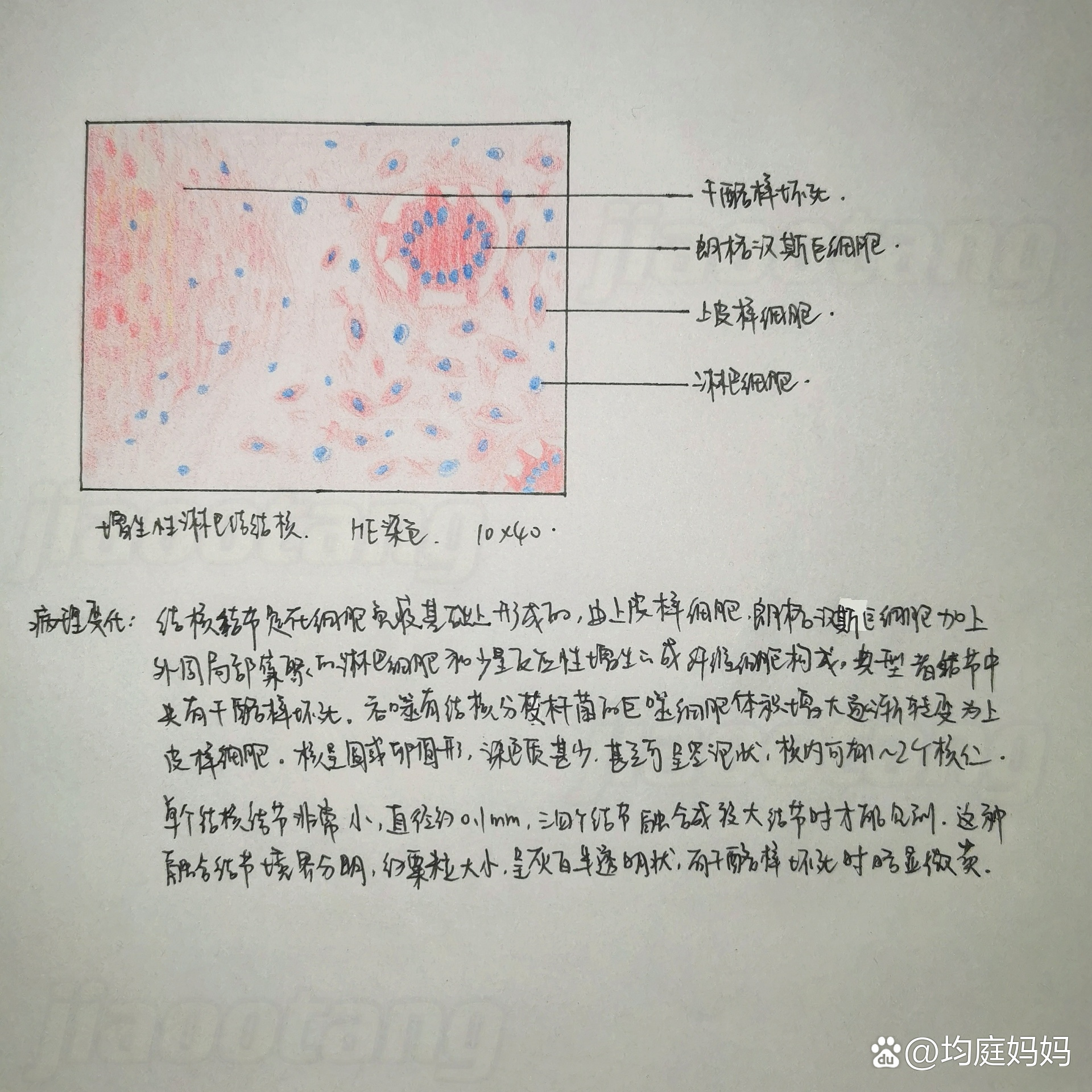 结核结节实验报告图片