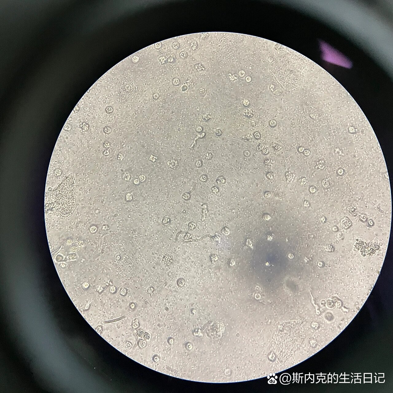 检验图片分享:尿标本