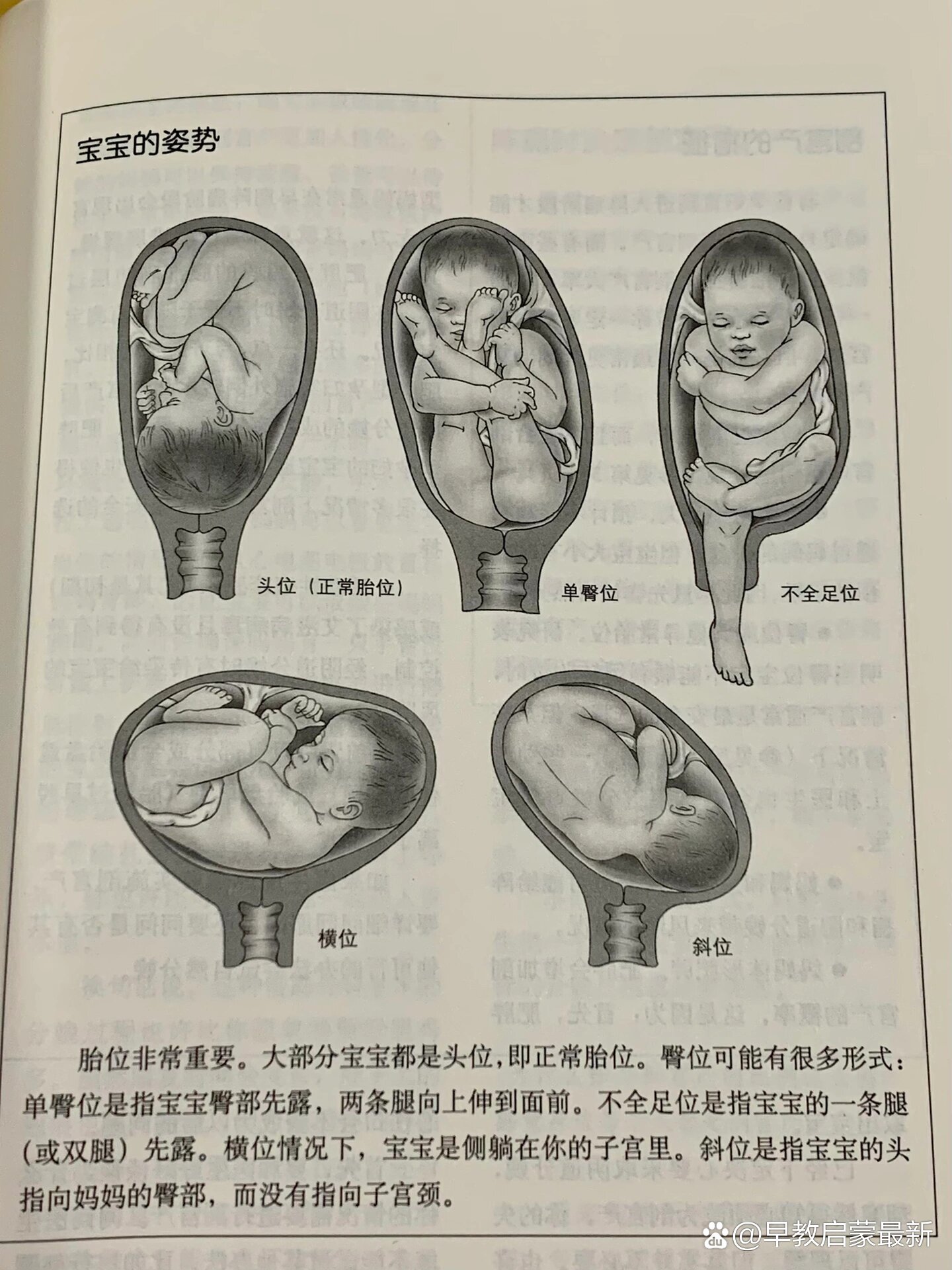 孕晚期的准妈妈们你的宝宝目前是什么胎位呀