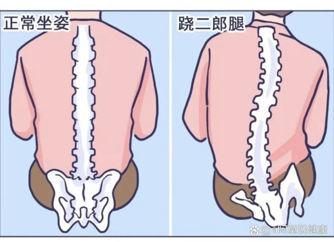 腰肌劳损正确坐姿图片