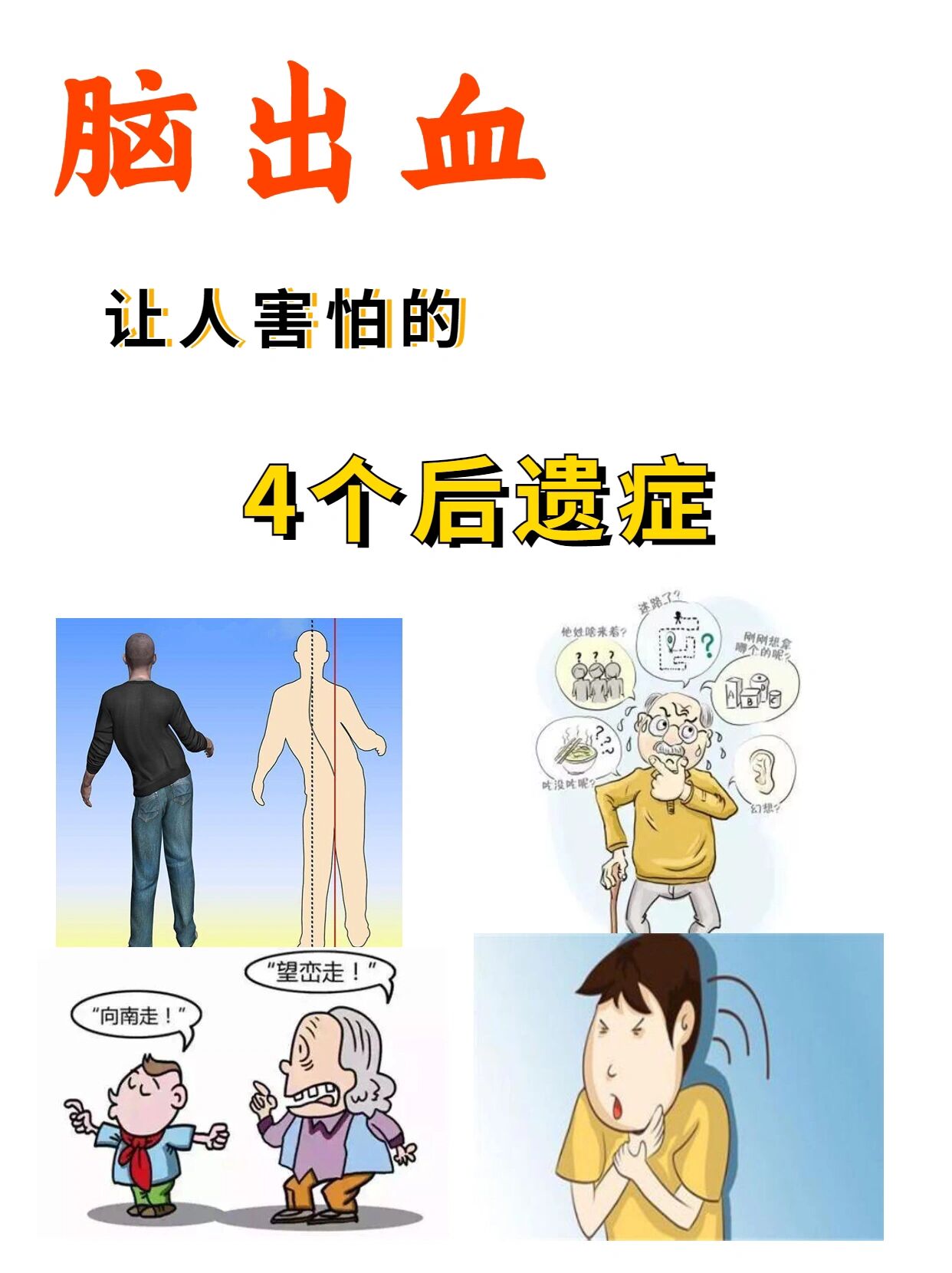 脑出血,治疗不好,会留下这4大后遗症