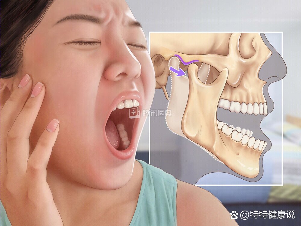 颞下颌关节疼痛