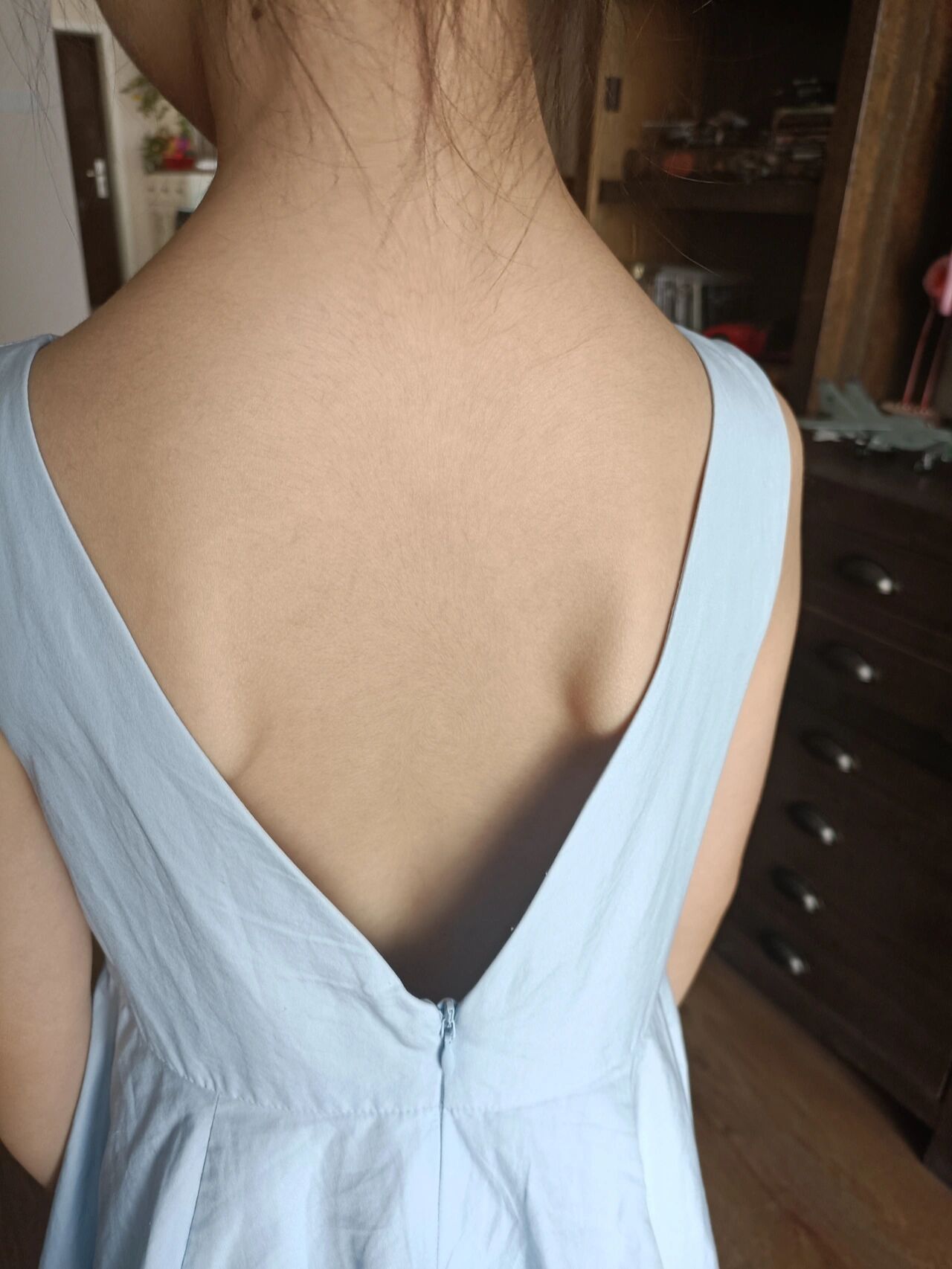 "蝴蝶骨"7岁女童