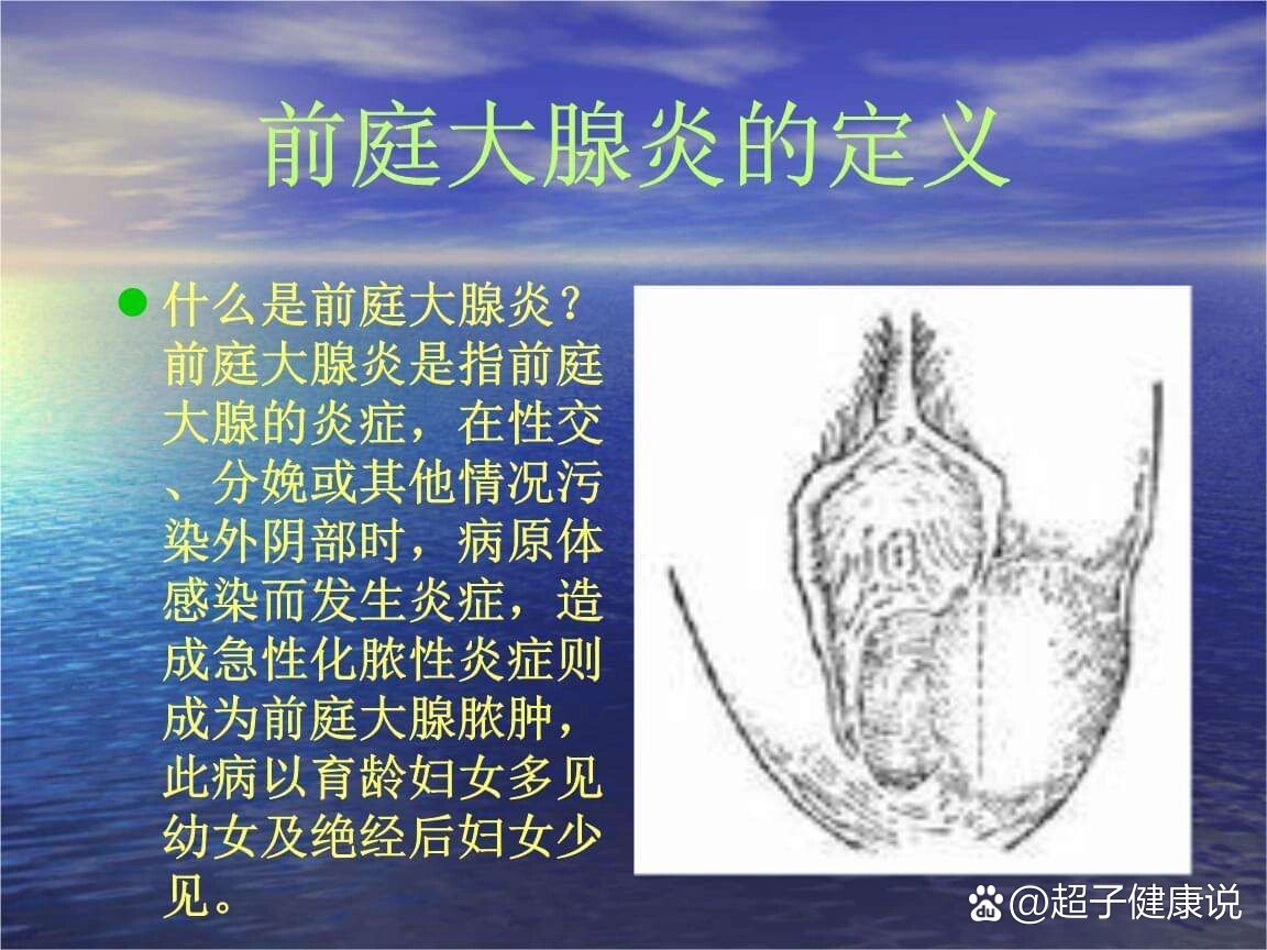 痛并爆笑的巴氏腺囊肿