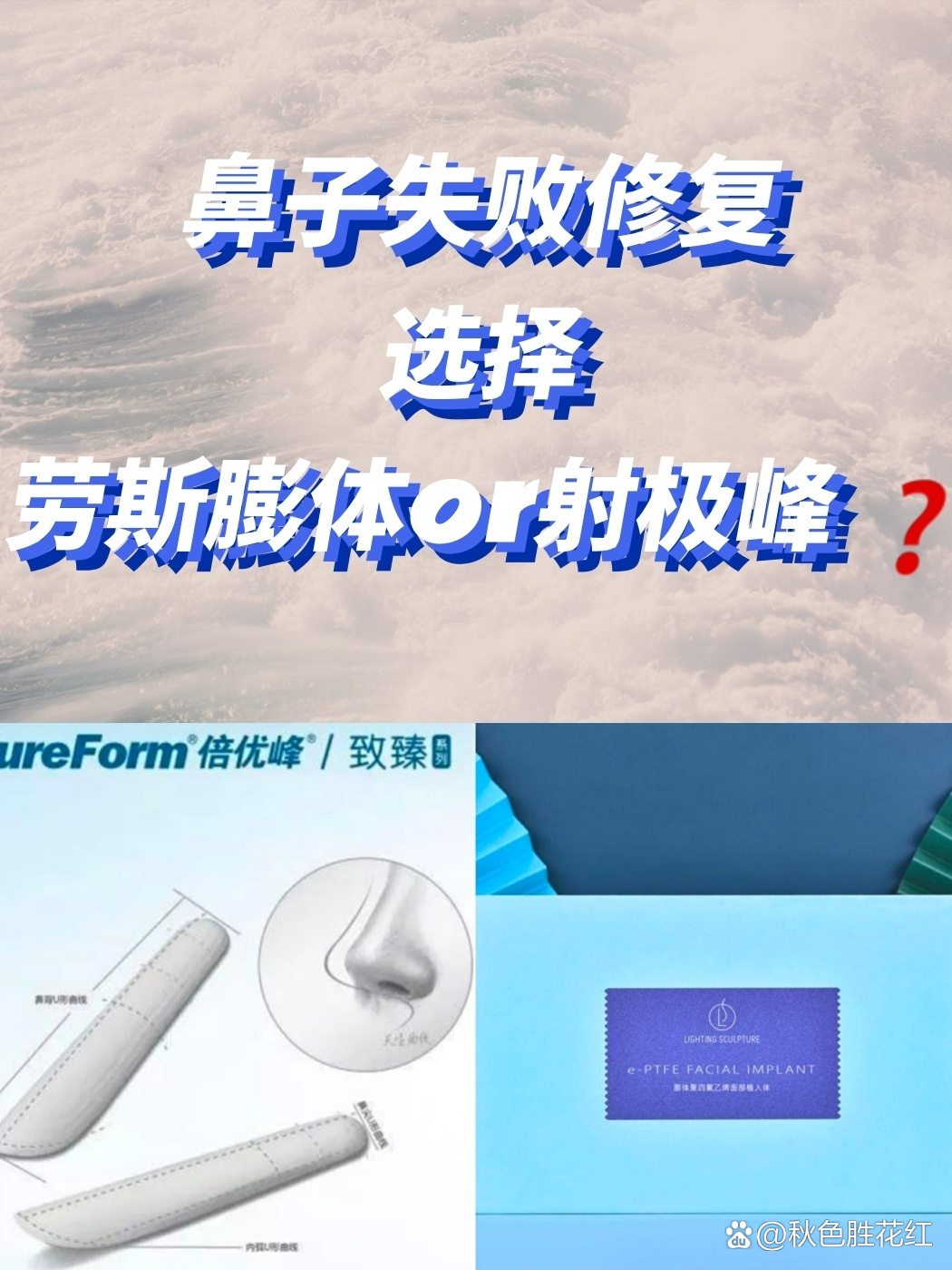 美国劳斯膨体和射极峰膨体的区别是什么?