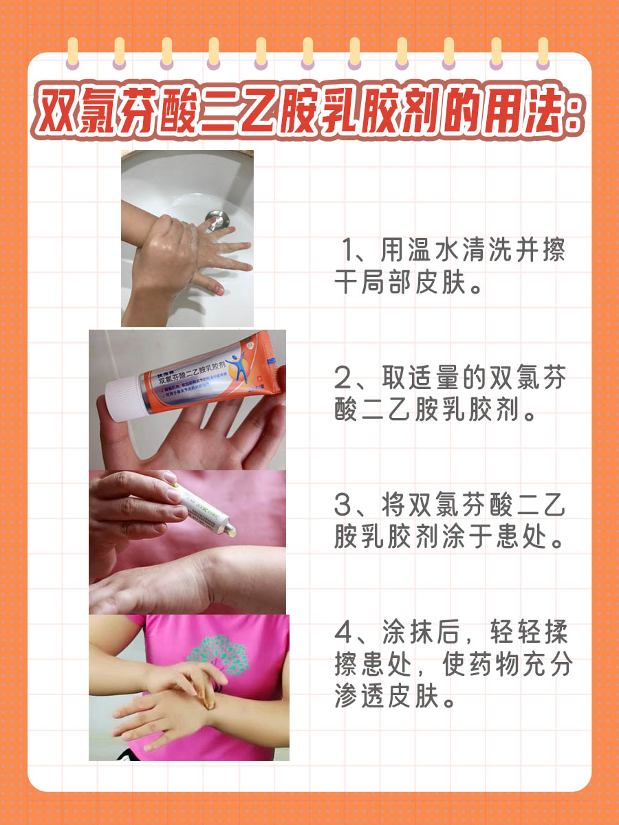 双氯芬酸二乙胺乳胶剂的作用与功效!就看此篇!