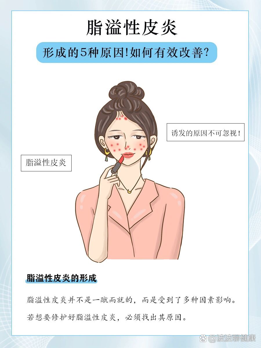 脂溢性皮炎形成的5大原因!