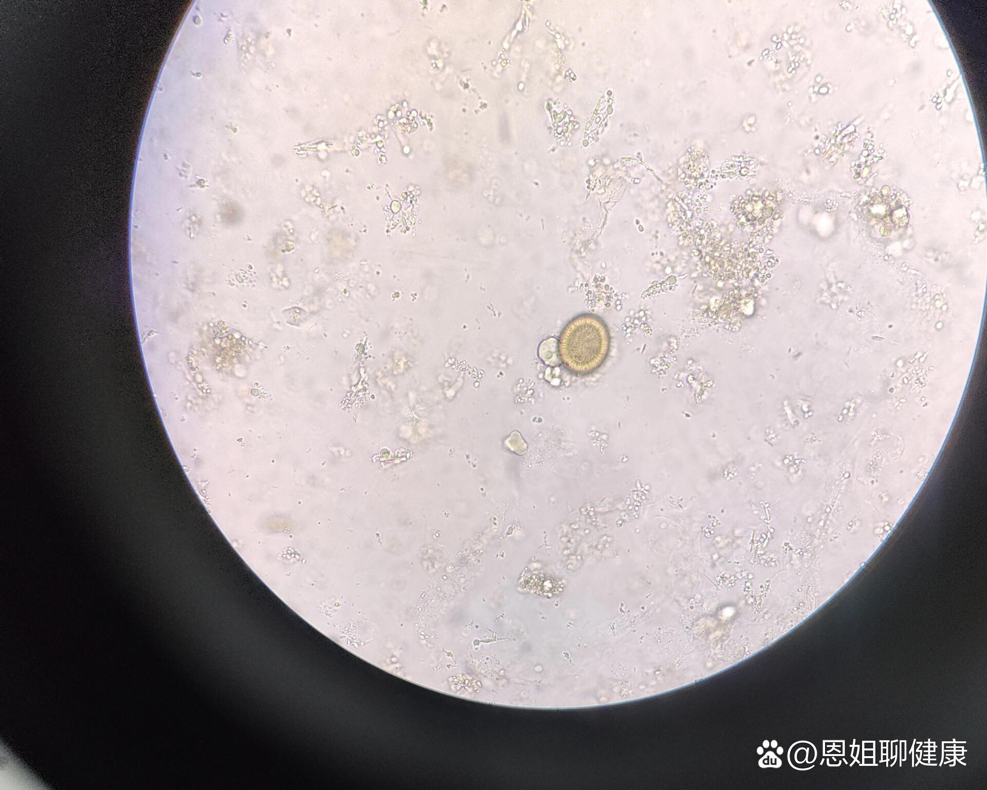 布氏姜片吸虫卵,猪/牛带绦虫卵