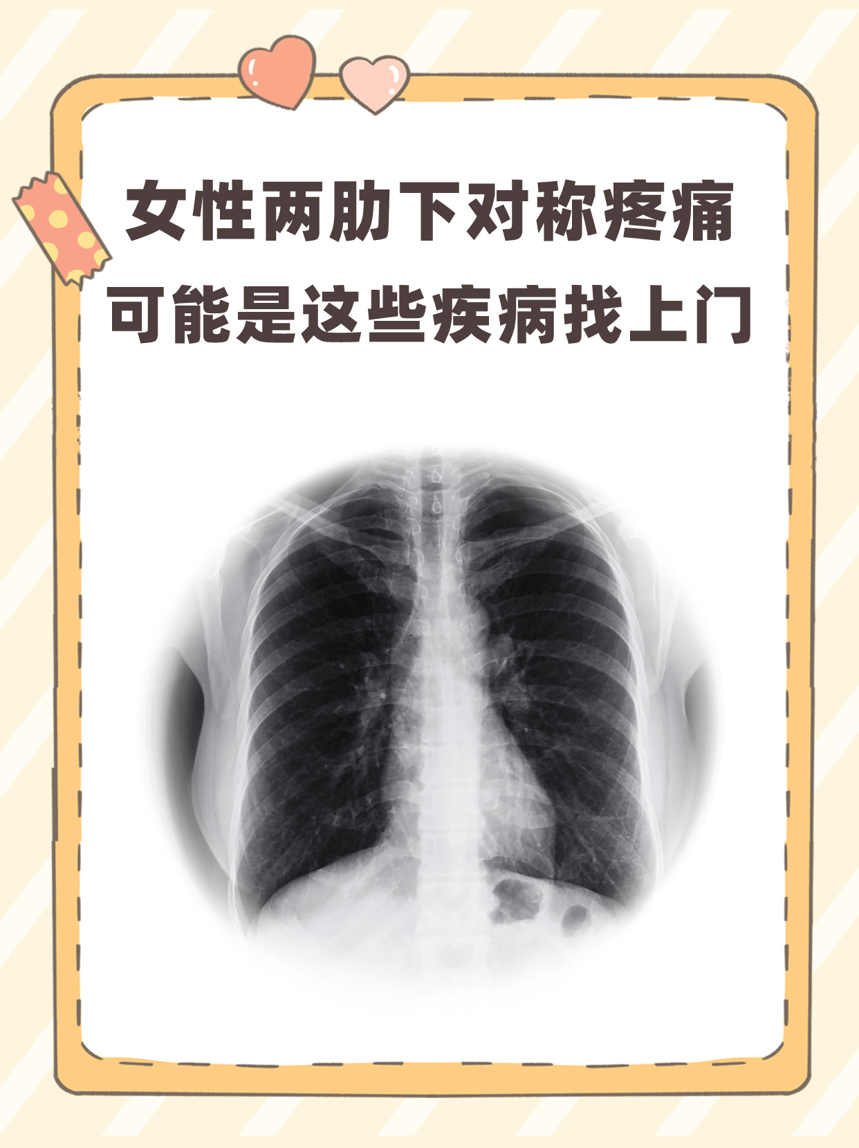 p>在一次繁忙的门诊工作中,我遇见了一位主诉双侧肋骨下缘对称疼痛的