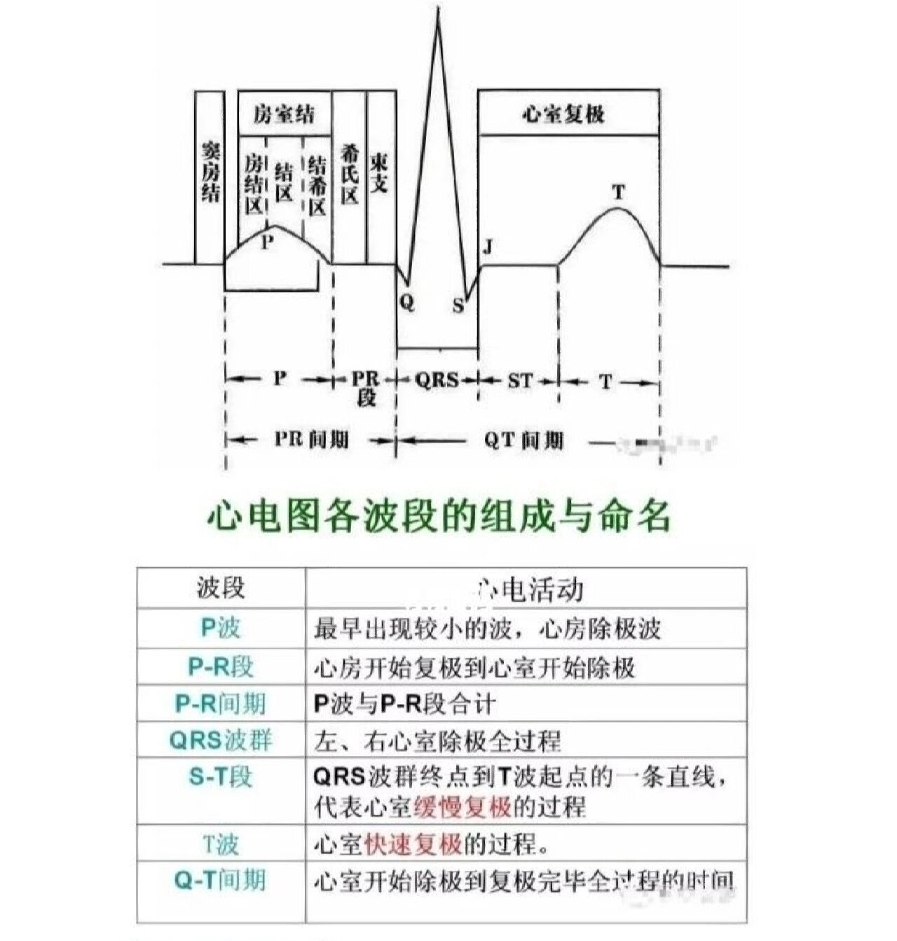 多通道十二导联心电图图片