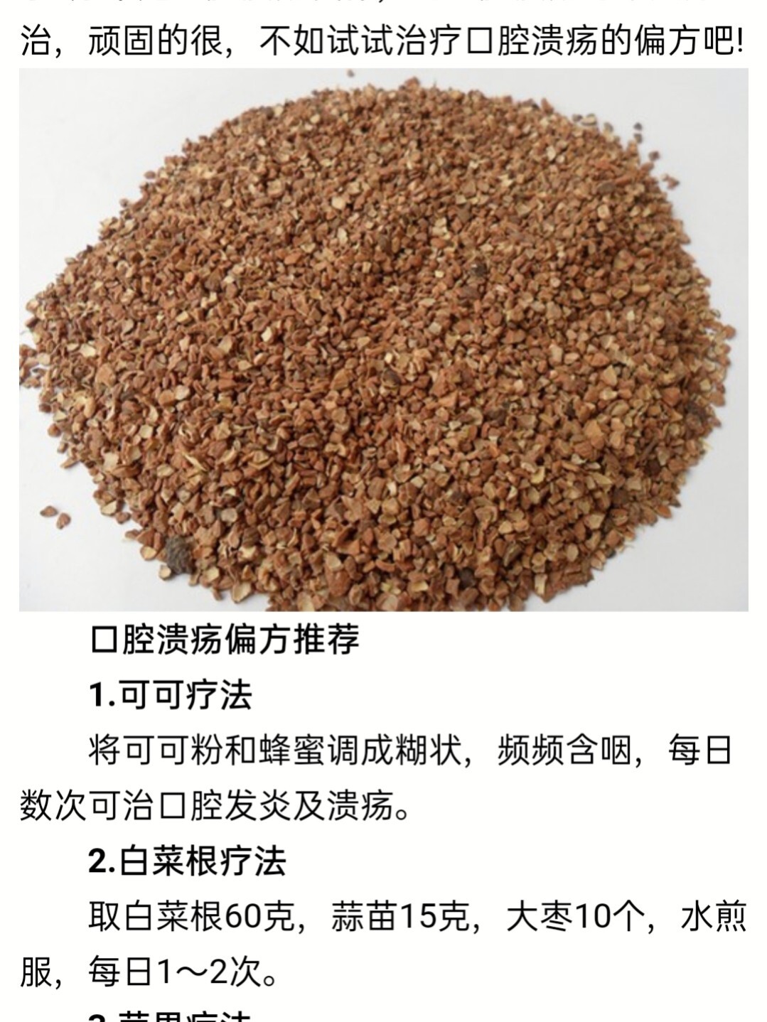 口腔溃疡小偏方