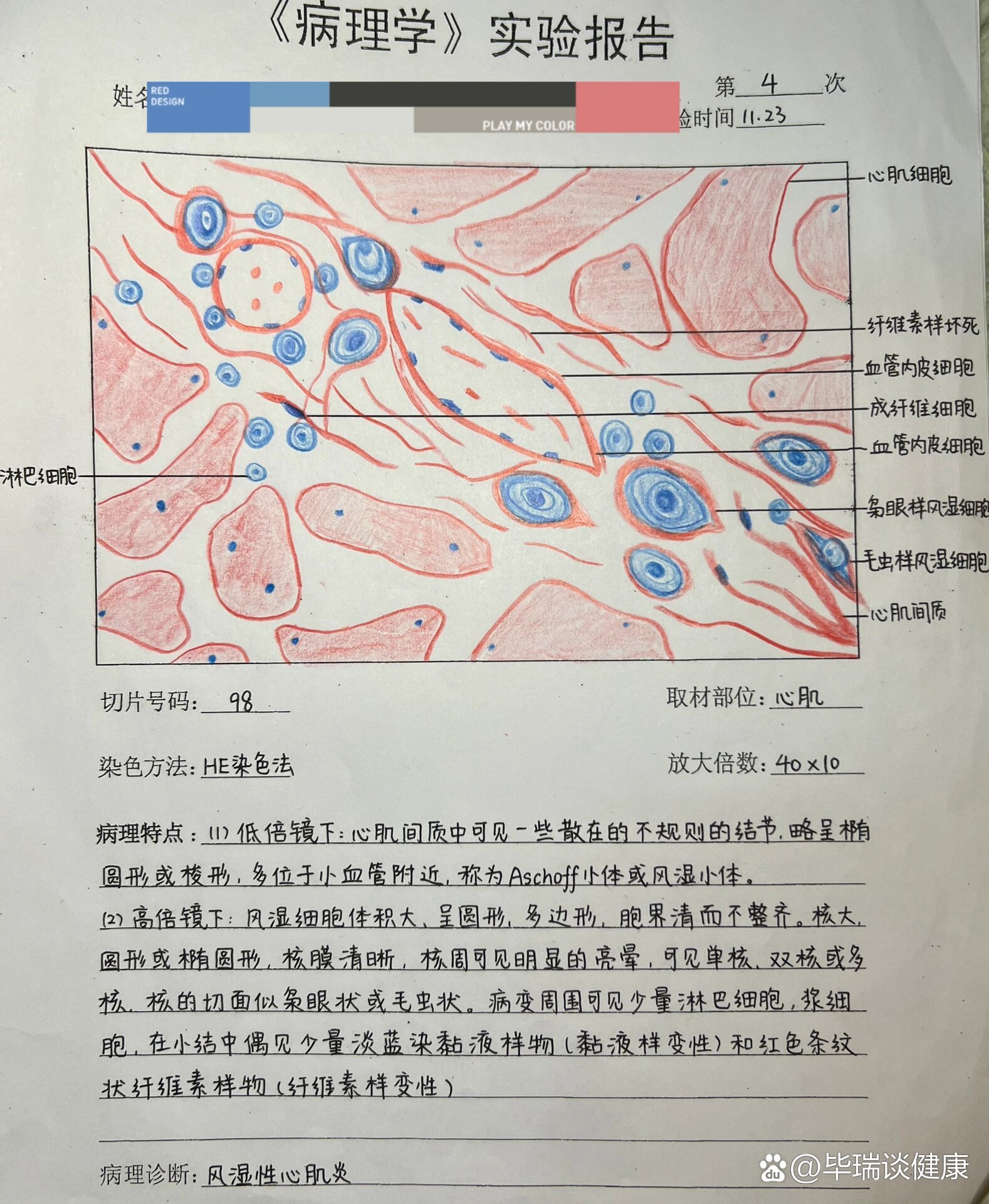 伤寒红蓝铅笔图图片