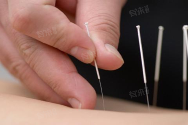 自己针灸有危险吗