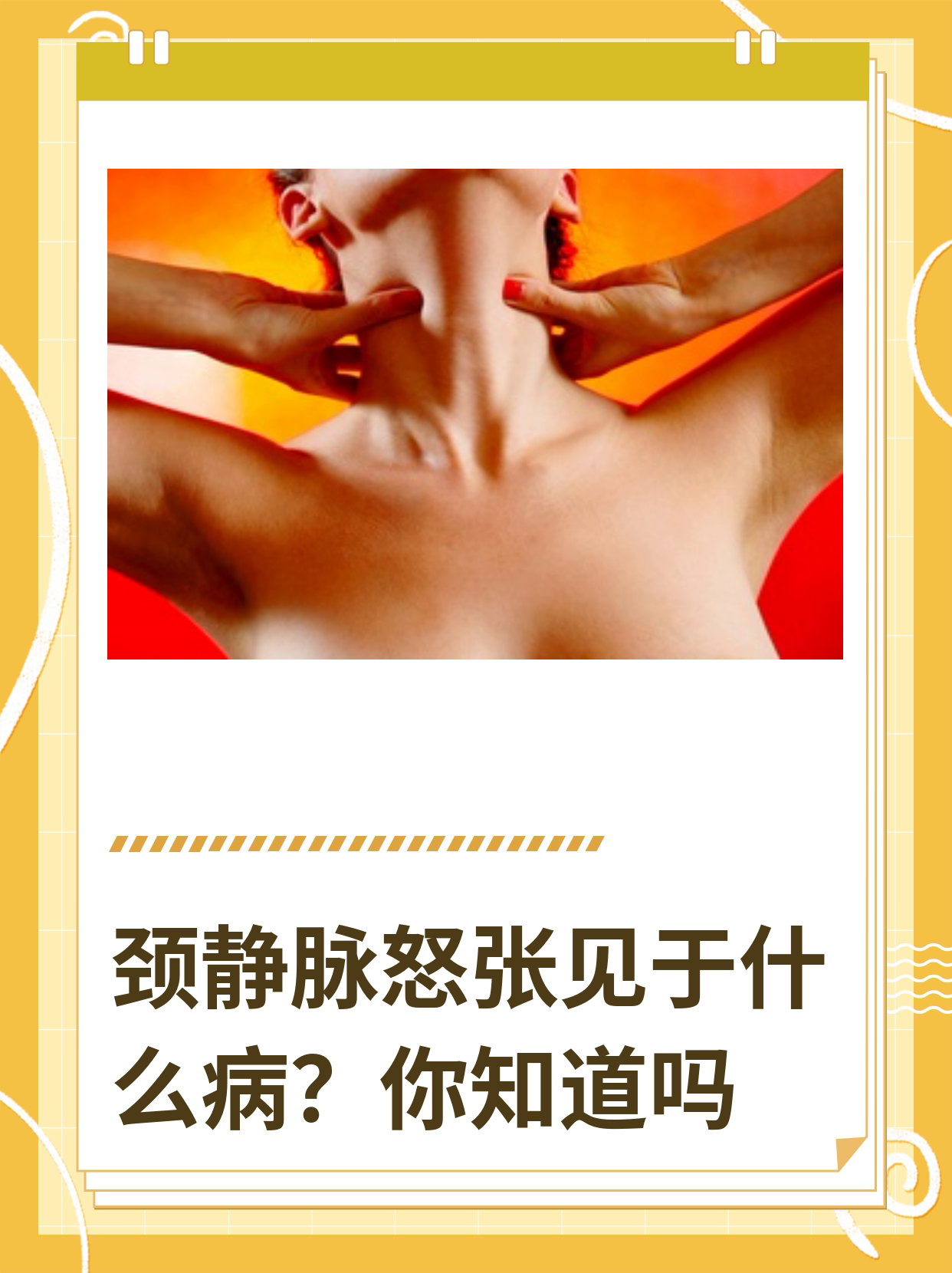 颈静脉怒张见于什么病?你知道吗