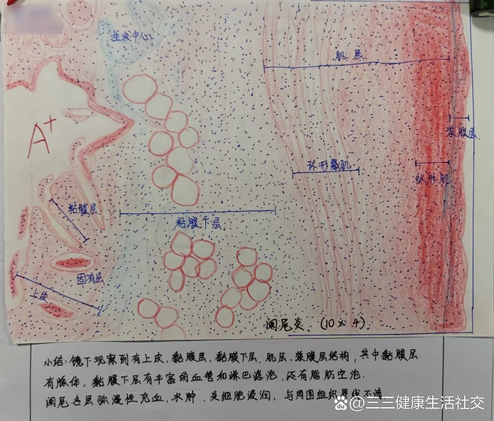 肠伤寒红蓝铅笔图图片