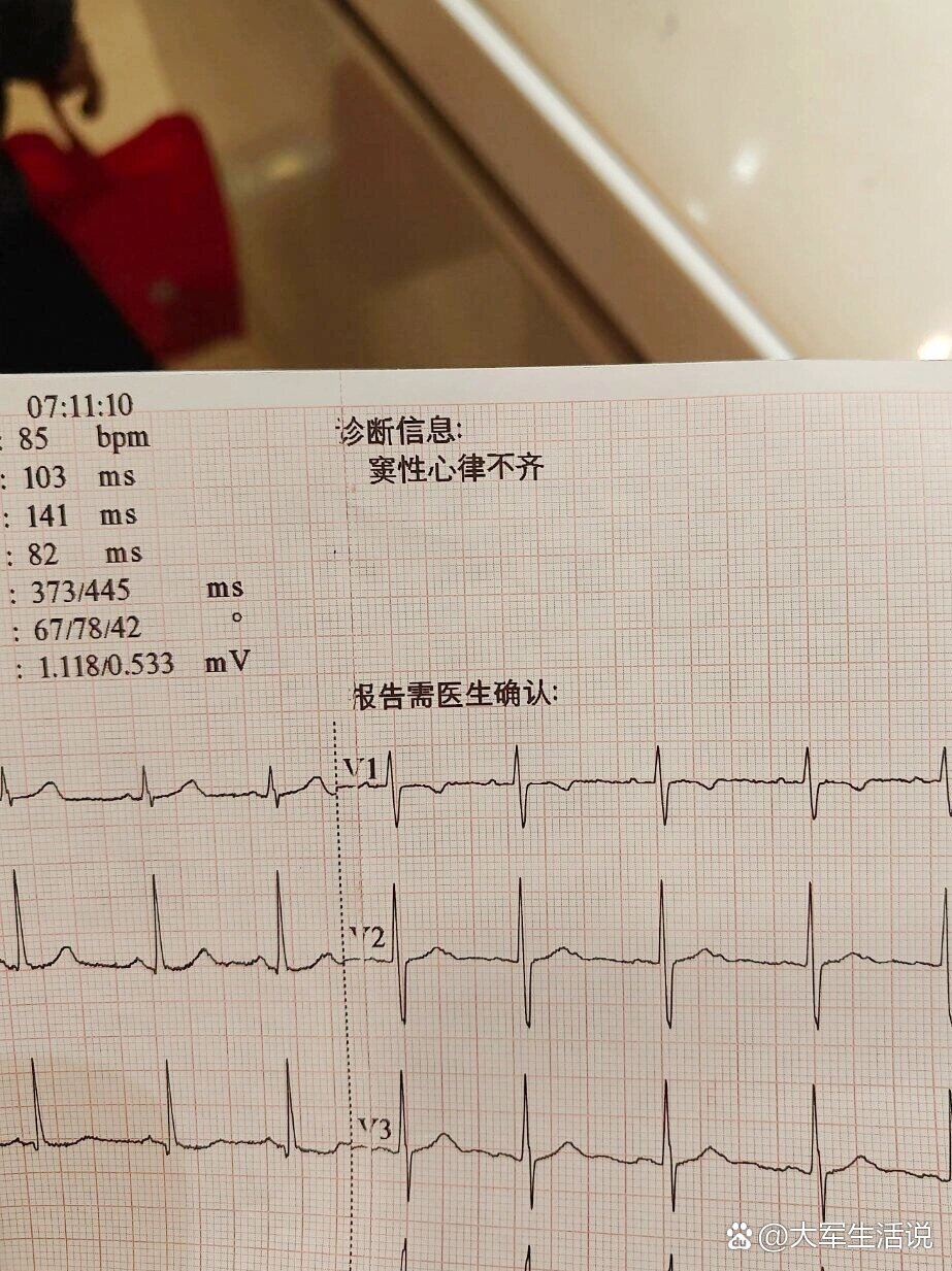 现在心律不齐的年轻人是越来越多了