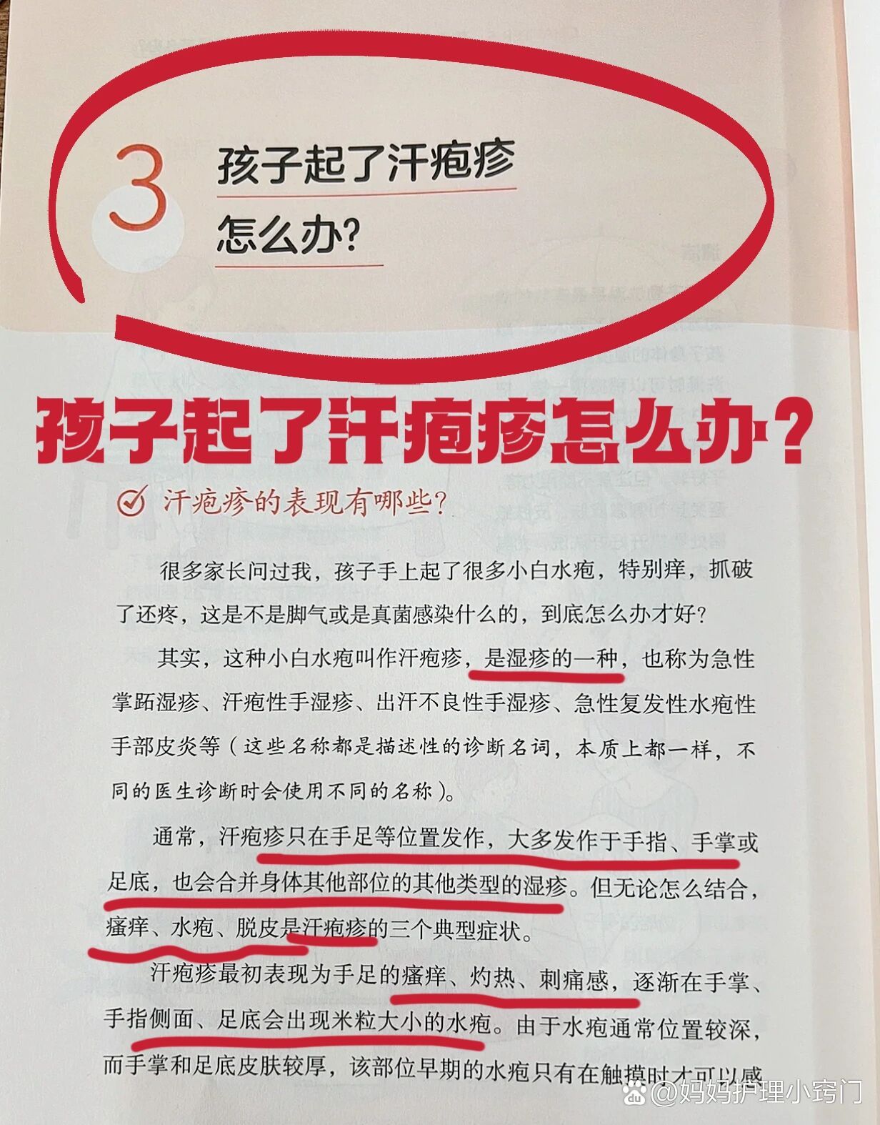 孩子得了汗疱疹怎么办?