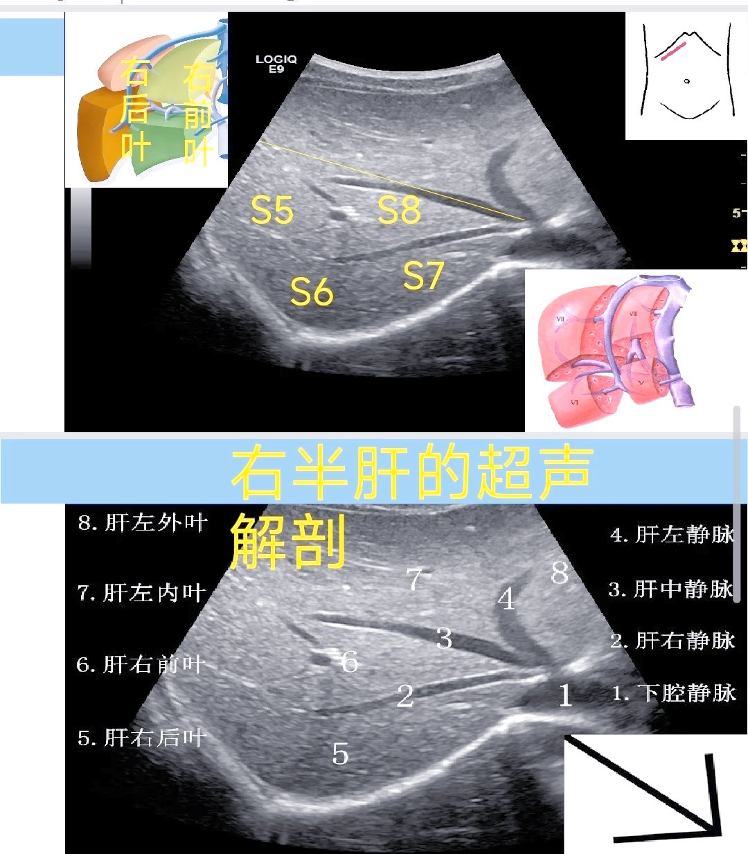 肝脏五叶八段详细解析