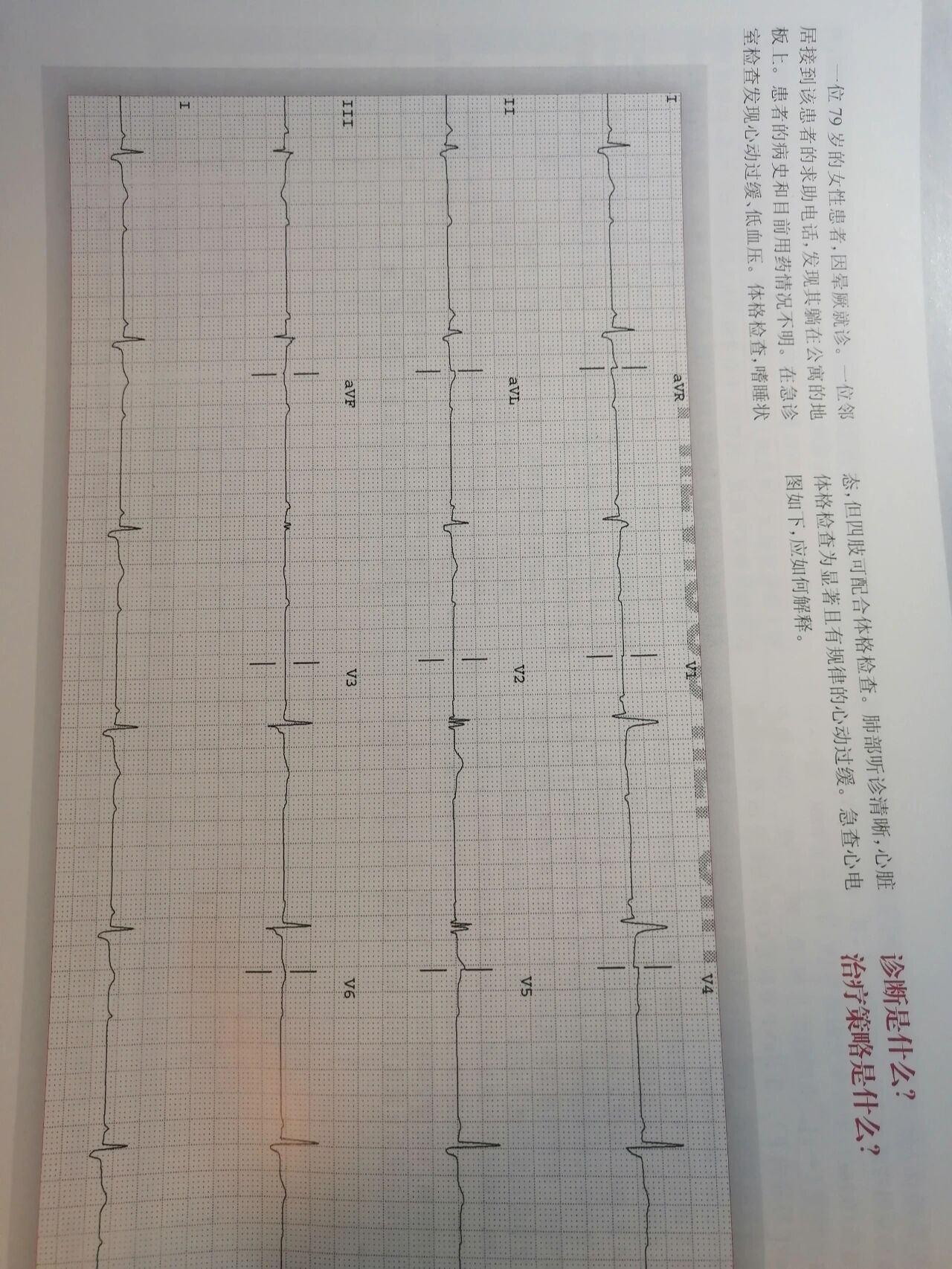 心电图辨认1