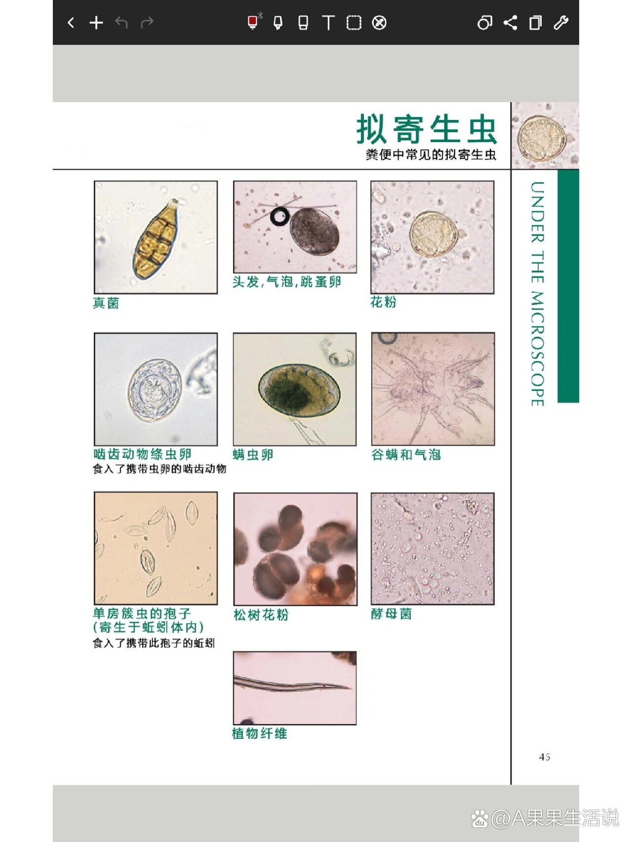 弓形虫,以及类似寄生虫显微镜的形态