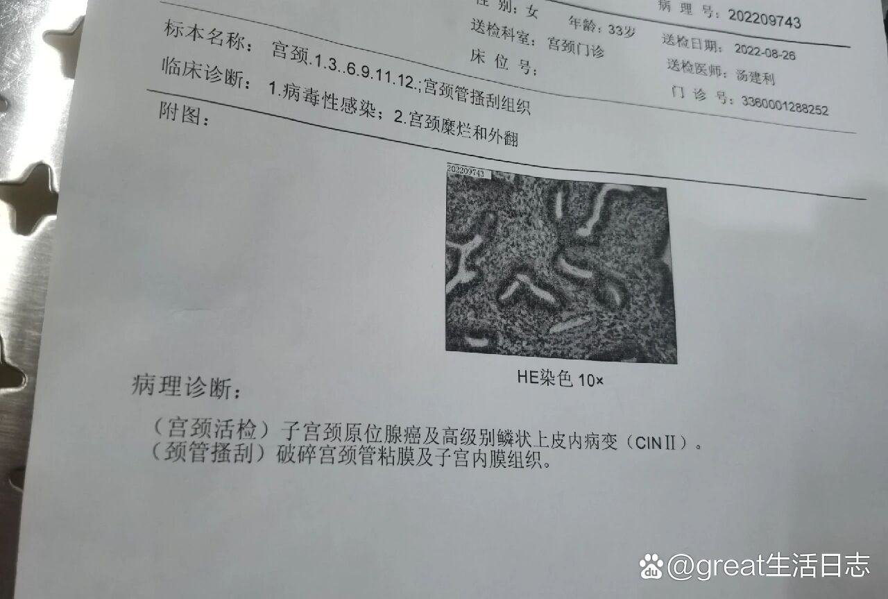 活检结果宫颈原位腺癌高级病变了
