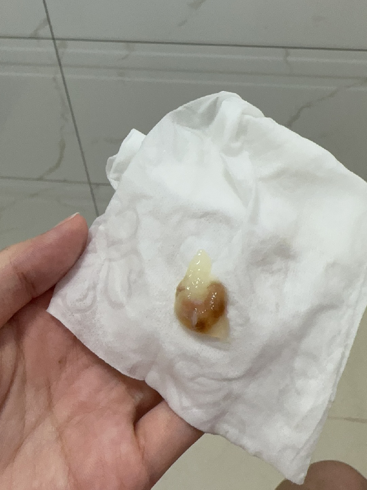 传说中的宫颈粘液栓,有图,介意勿往后翻