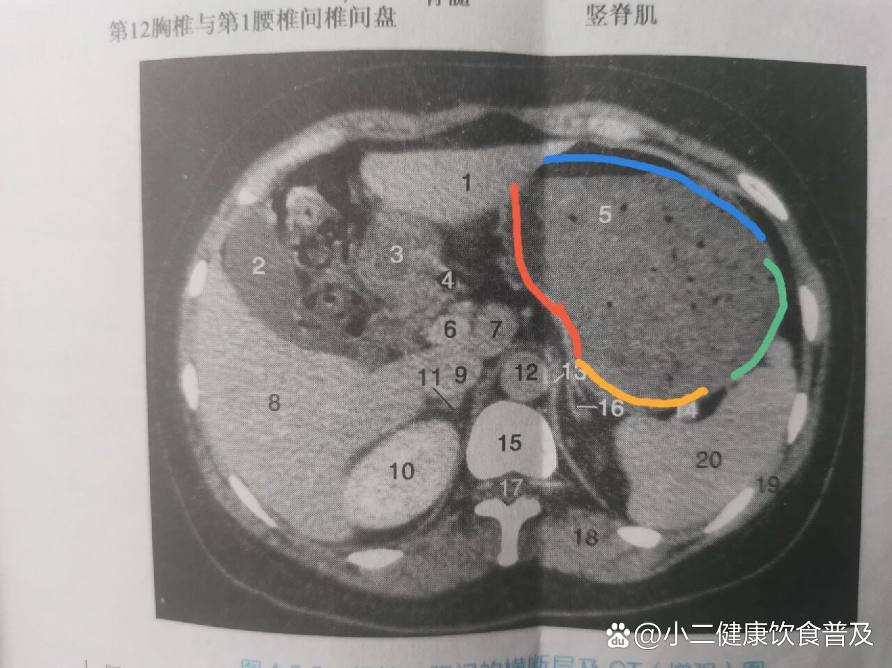 胃的ct横断面解剖