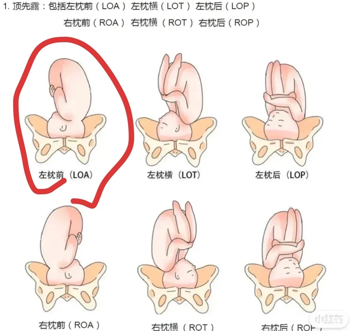 孕22周胎心位置示意图图片