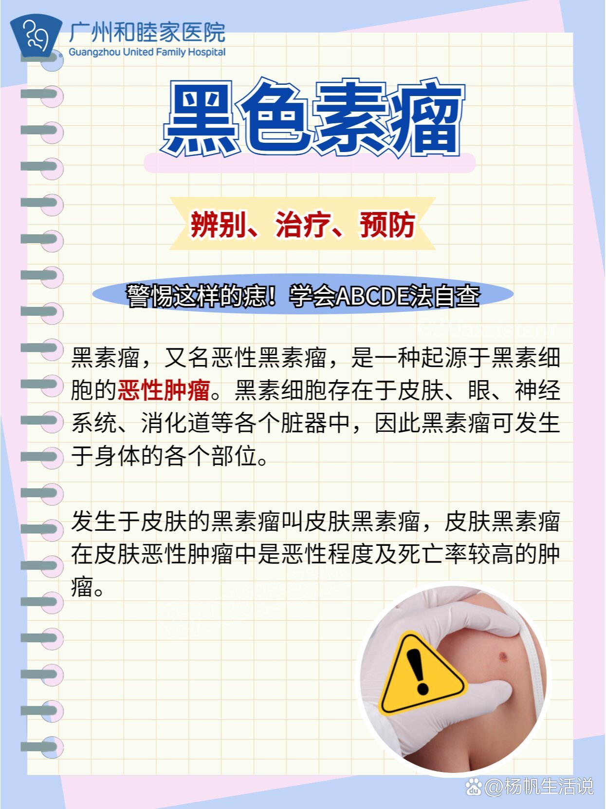 凶险的黑色素瘤60一定要重视这种痣!