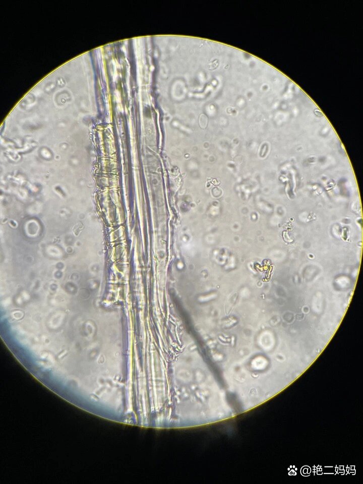 甘草粉末显微图