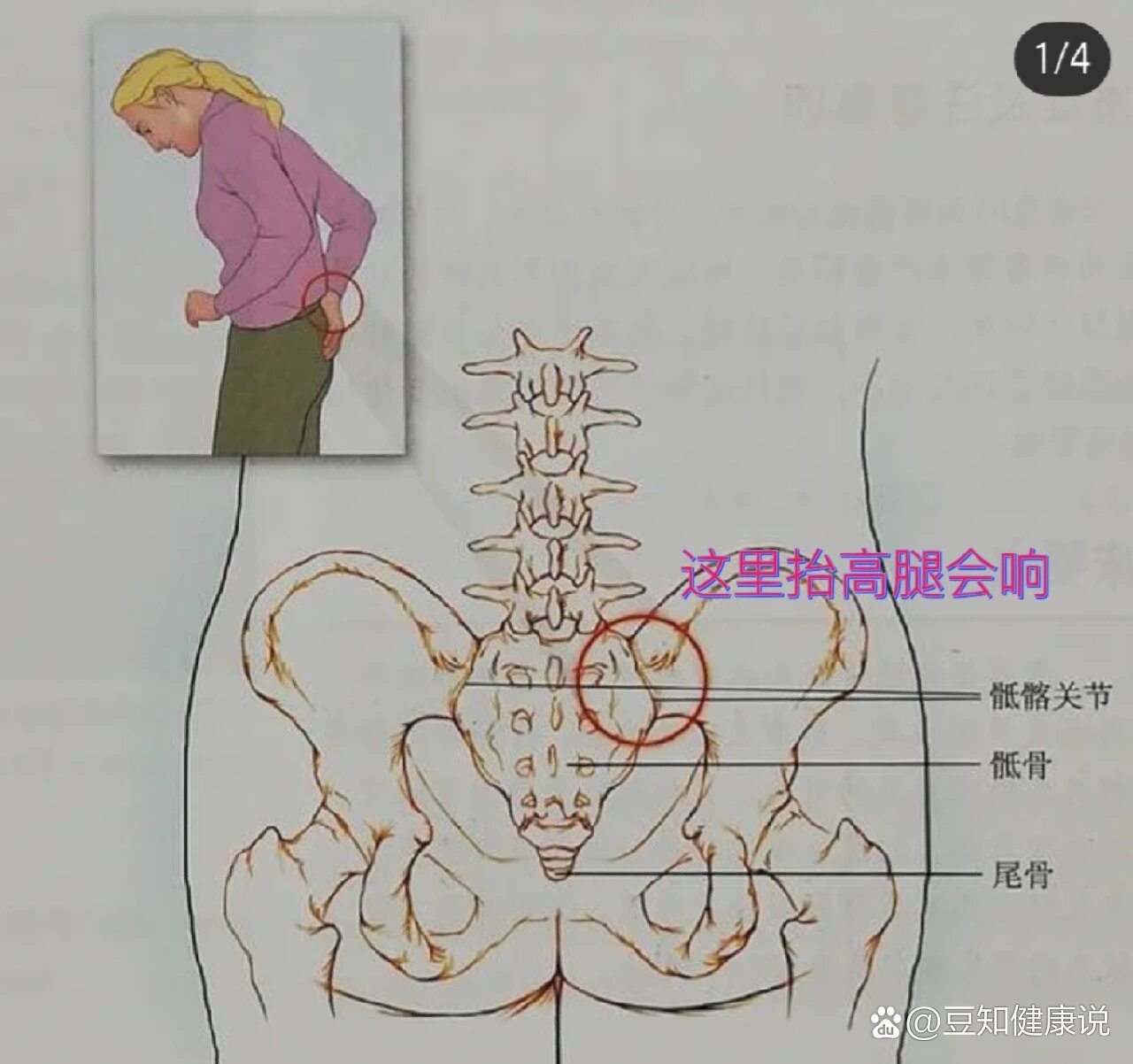 下颌骨致密性骨炎图片图片