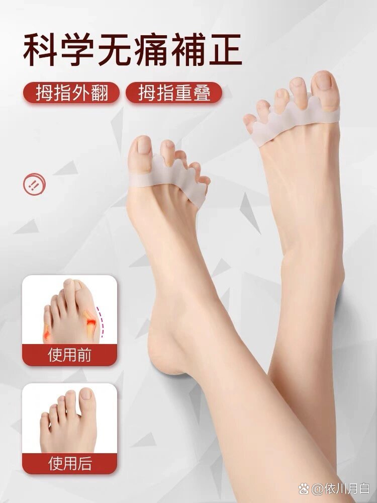 脚趾矫正器五孔分趾套重叠指分离器