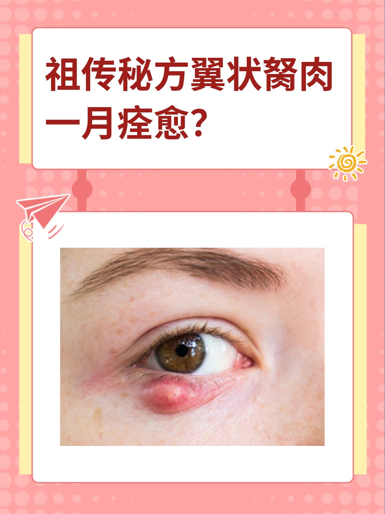 祖传秘方翼状胬肉一月痊愈