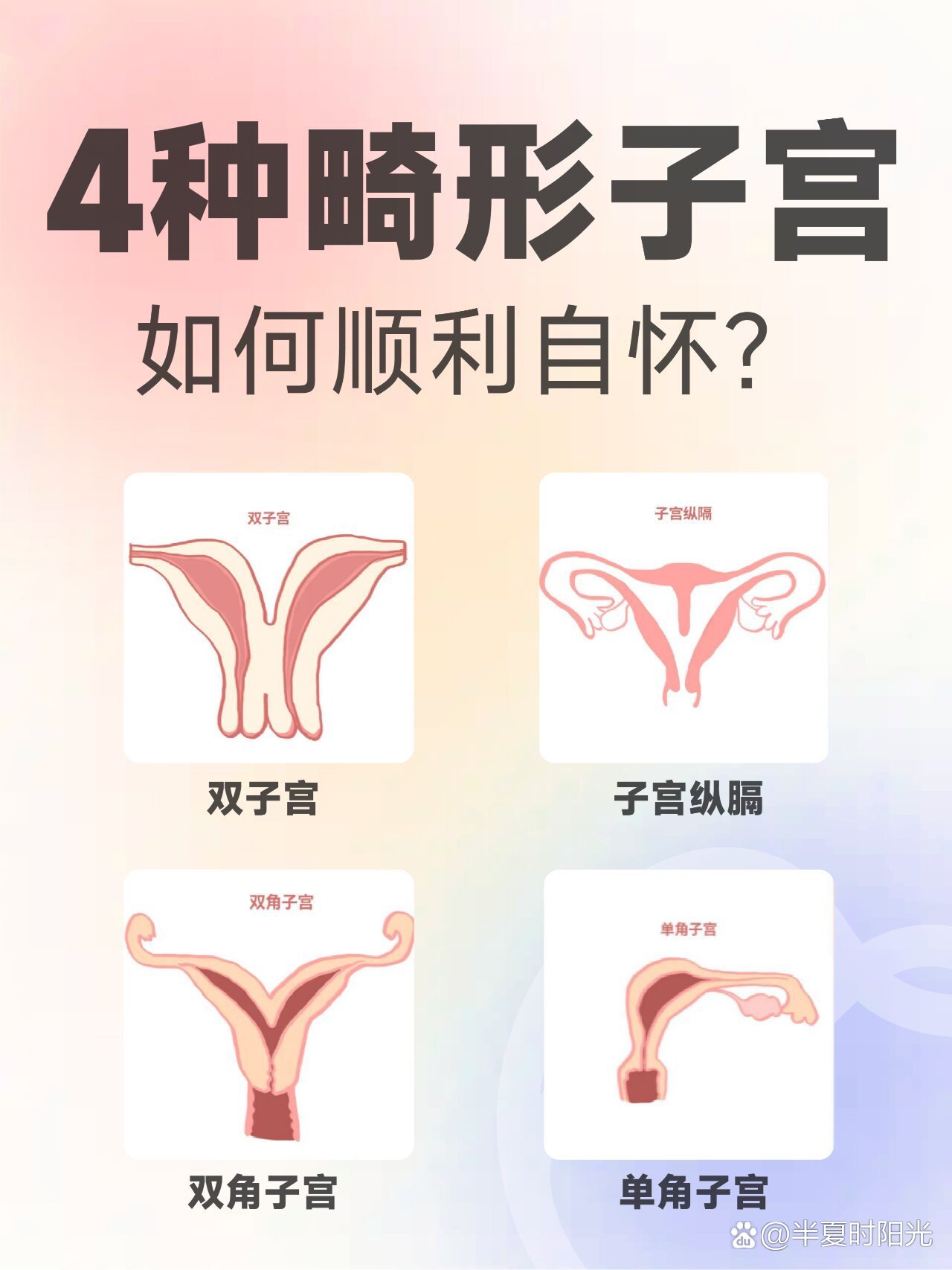 畸形子宫形态图片