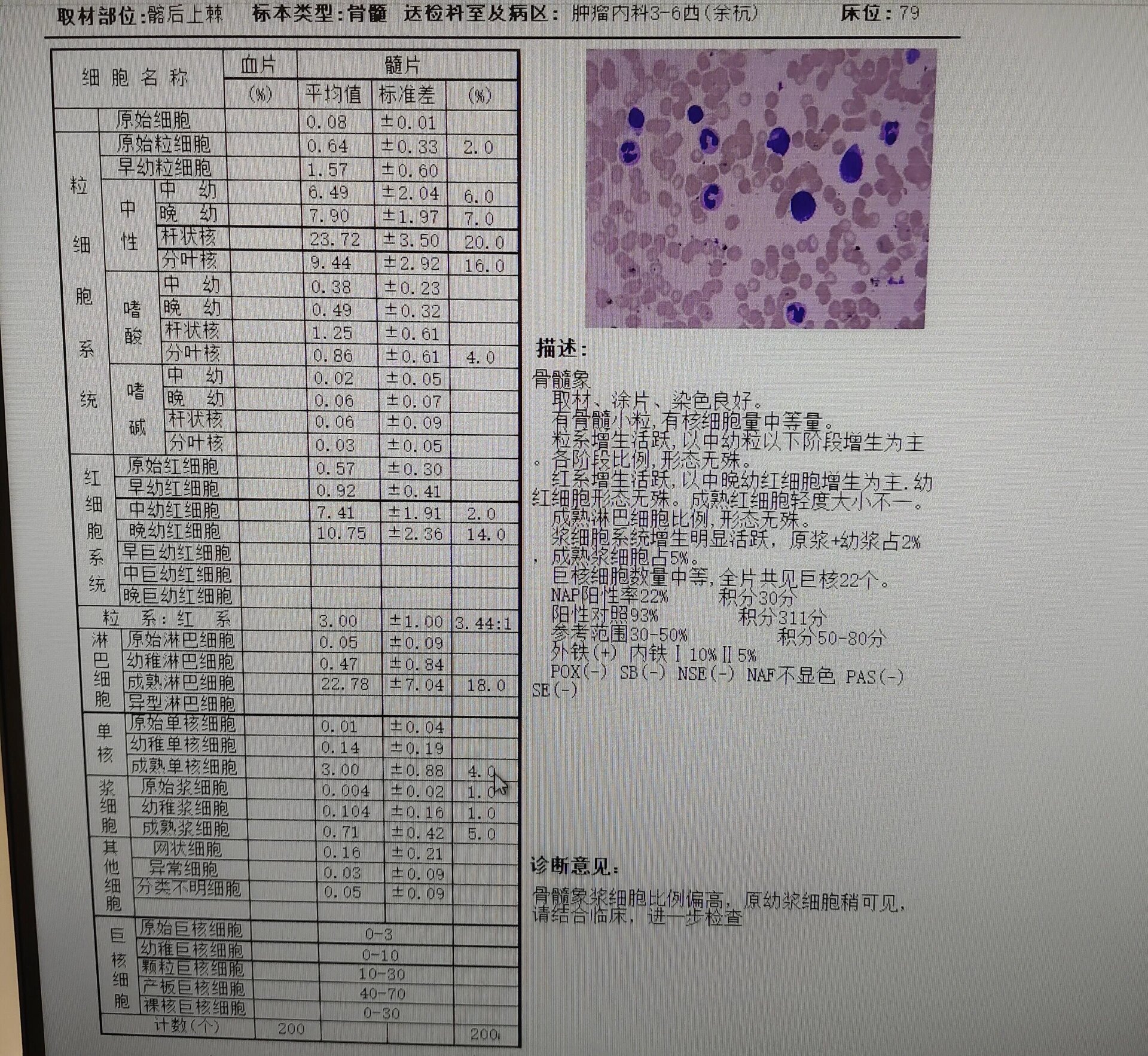 骨穿报告图片