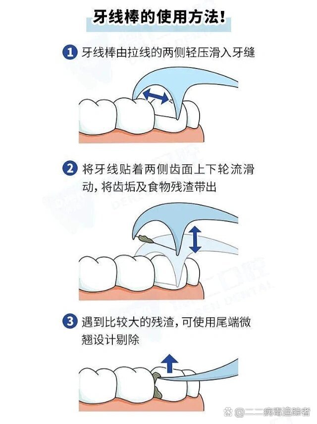 用牙线牙缝会不会变大图片