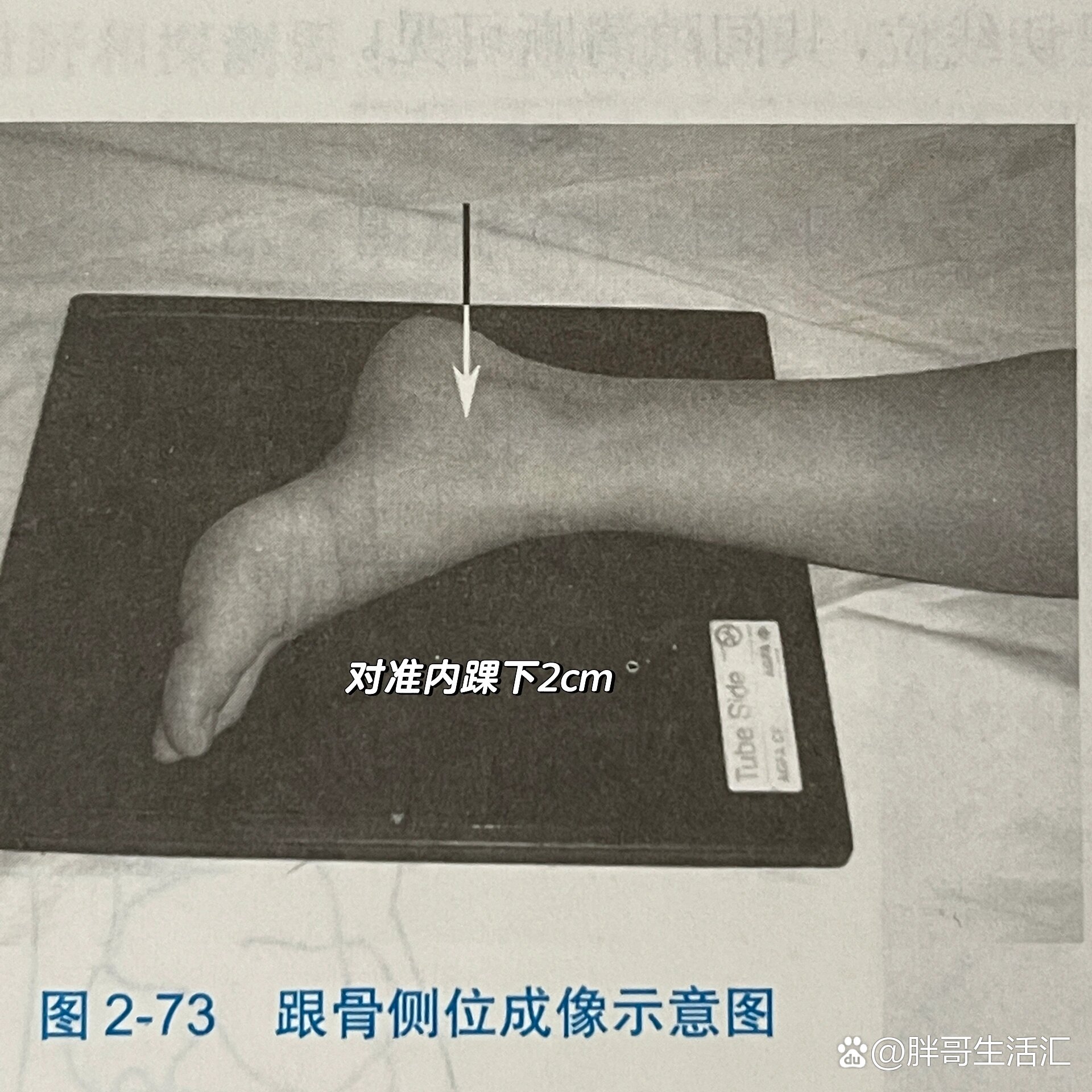 跟骨侧位&跟骨轴位